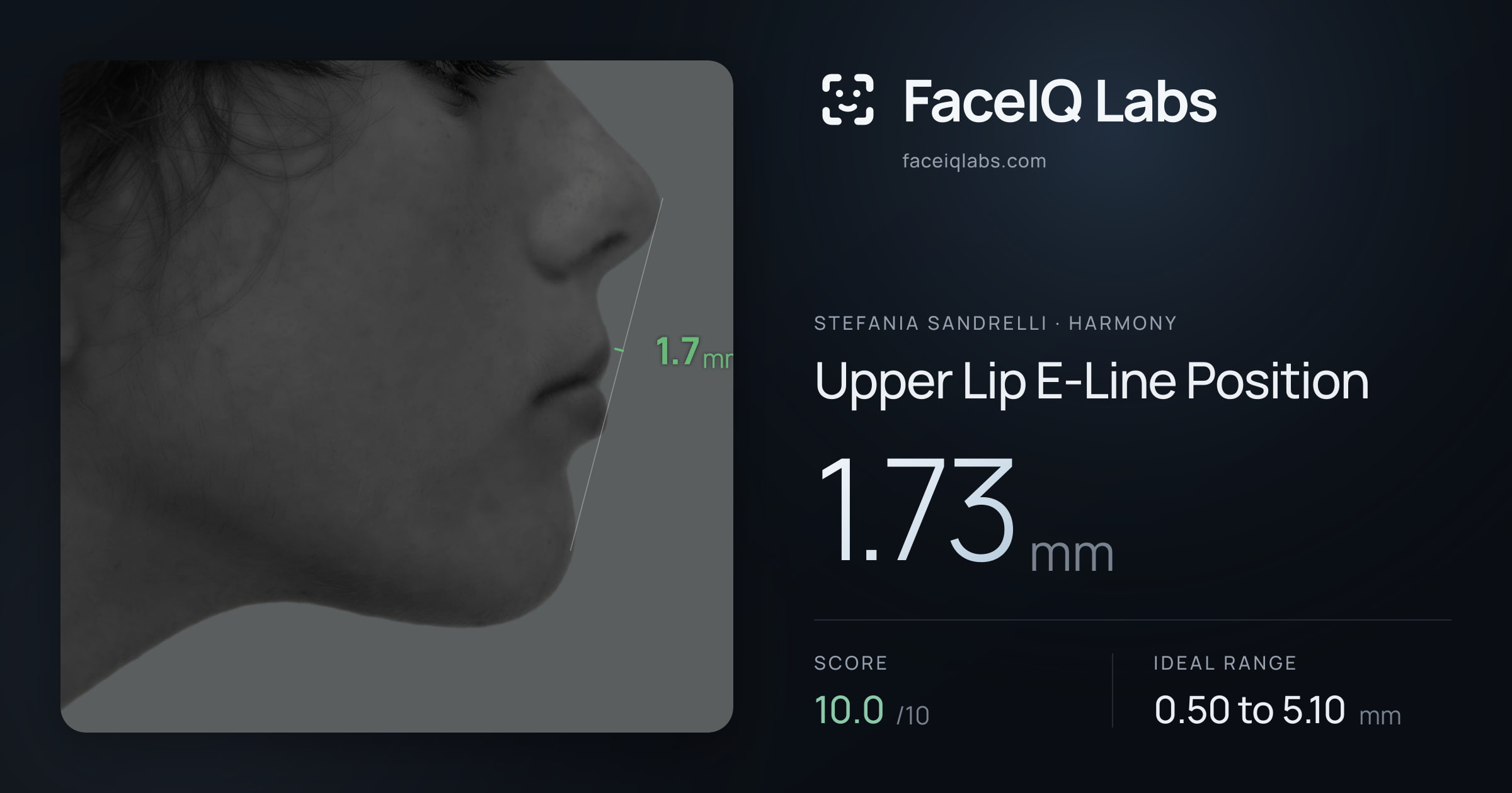 Stefania Sandrelli Upper Lip E-Line Position: 1.73mm, drawn on the photo
