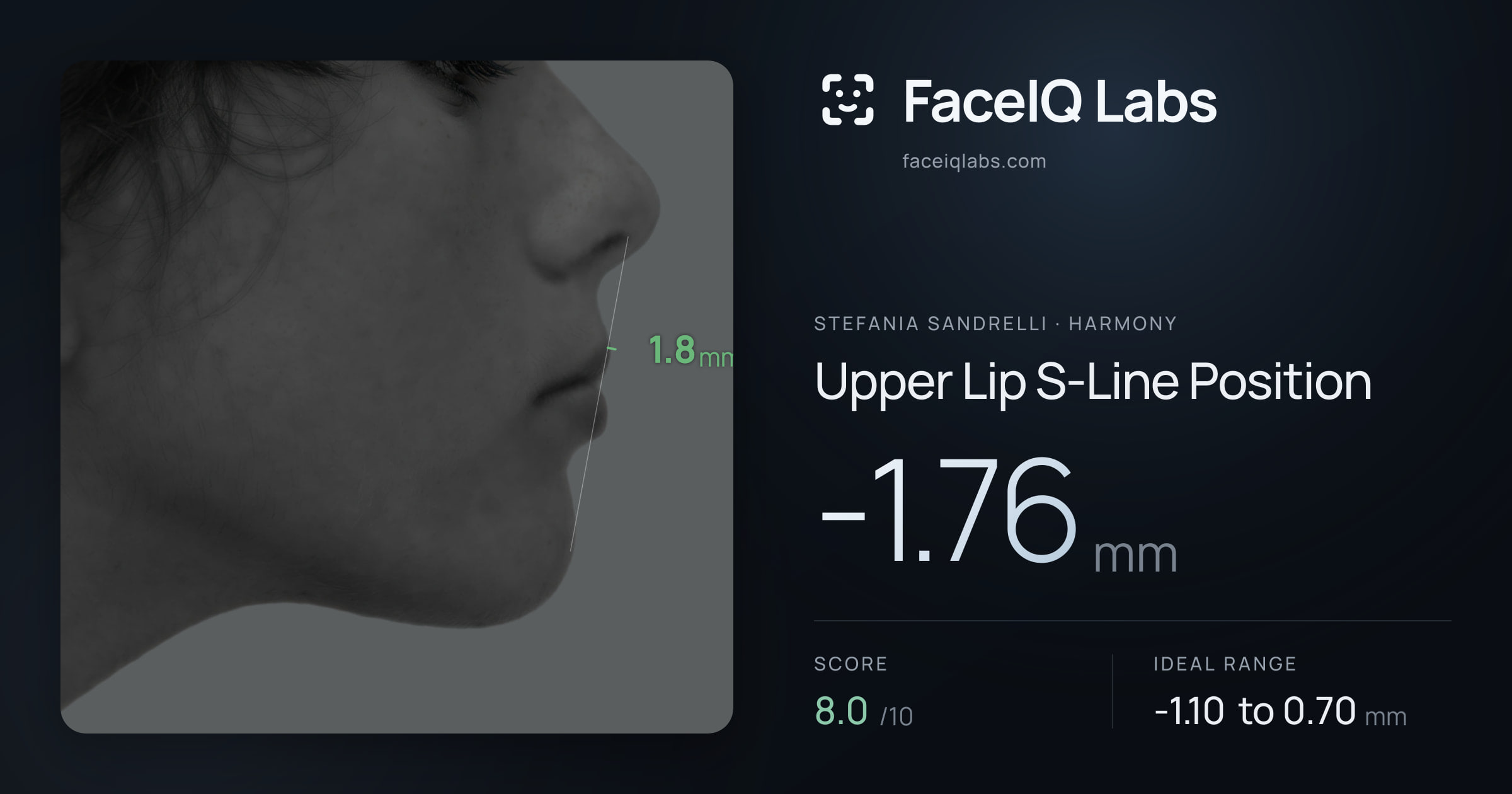 Stefania Sandrelli Upper Lip S-Line Position: -1.76mm, drawn on the photo