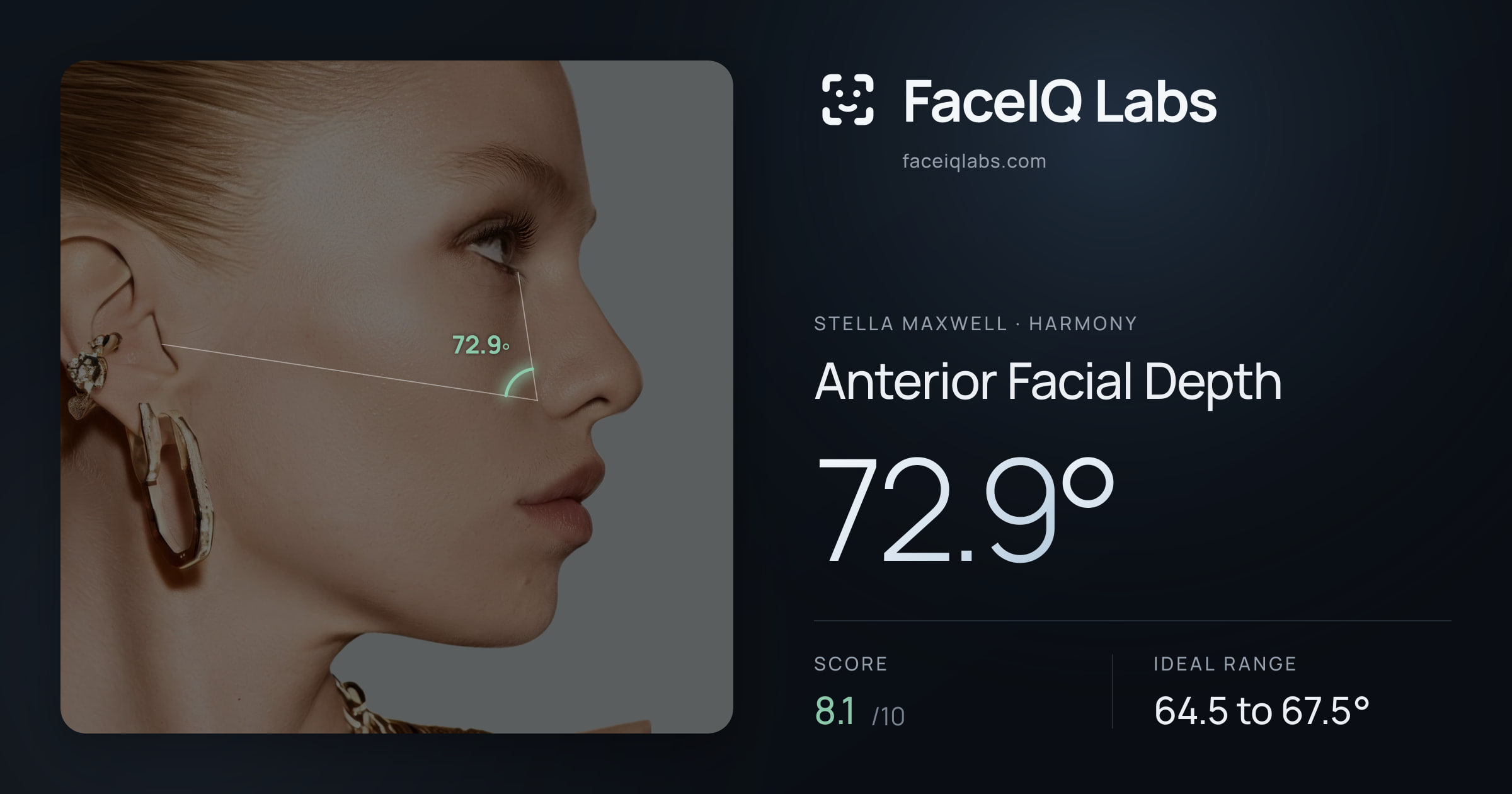 Stella Maxwell Anterior Facial Depth: 72.9°, drawn on the photo