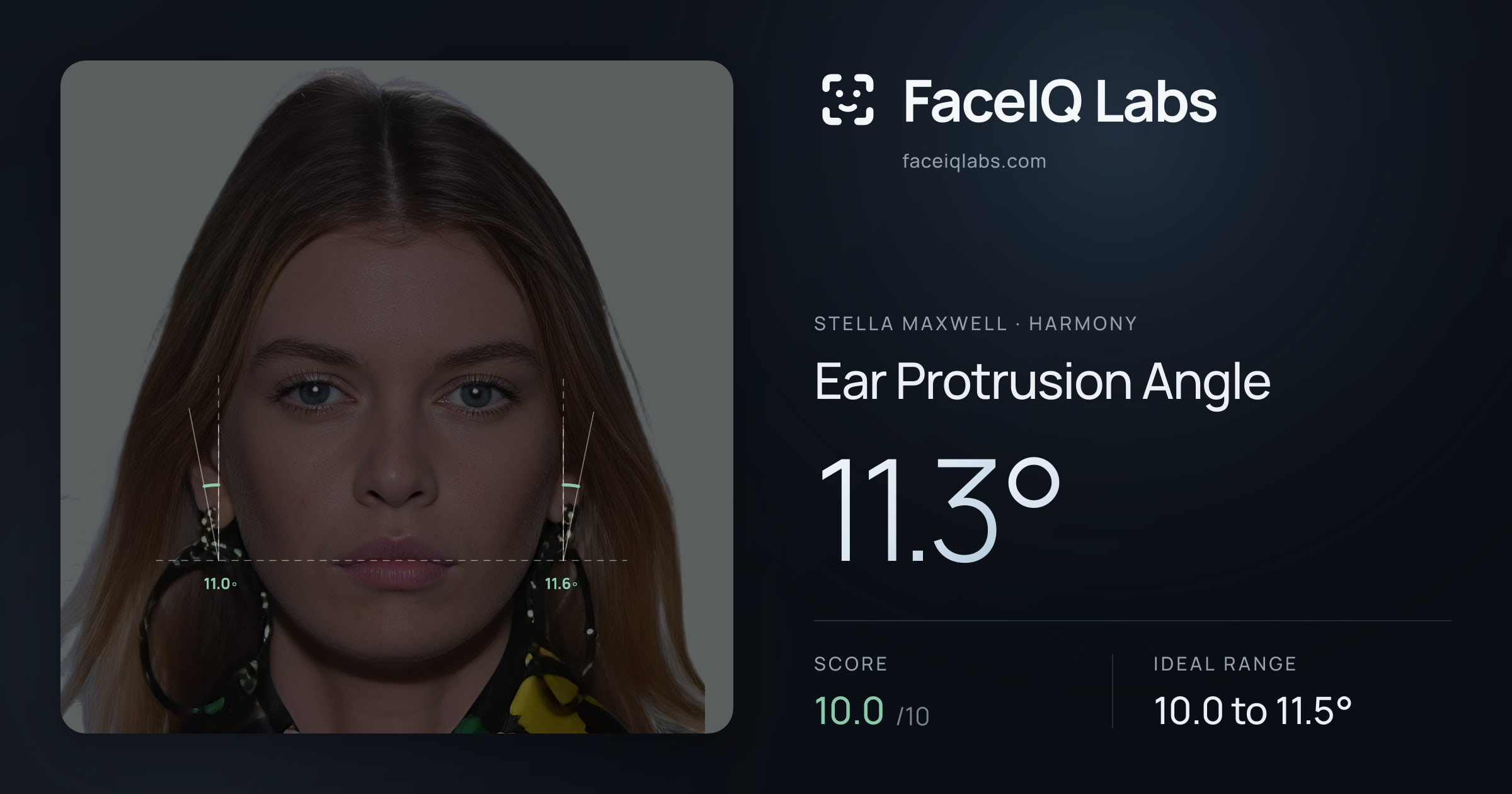 Stella Maxwell Ear Protrusion Angle: 11.3°, drawn on the photo