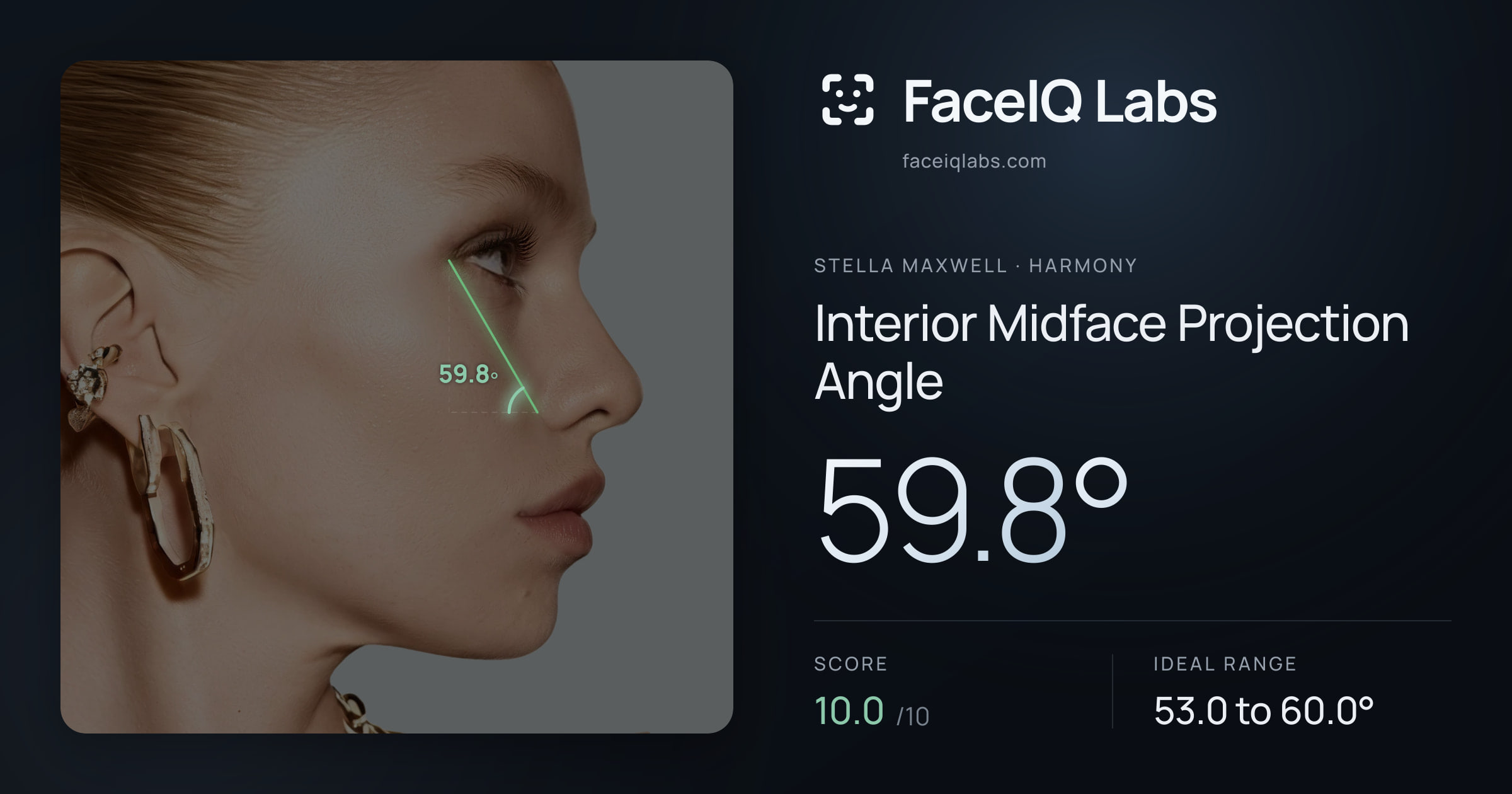 Stella Maxwell Interior Midface Projection Angle: 59.8°, drawn on the photo