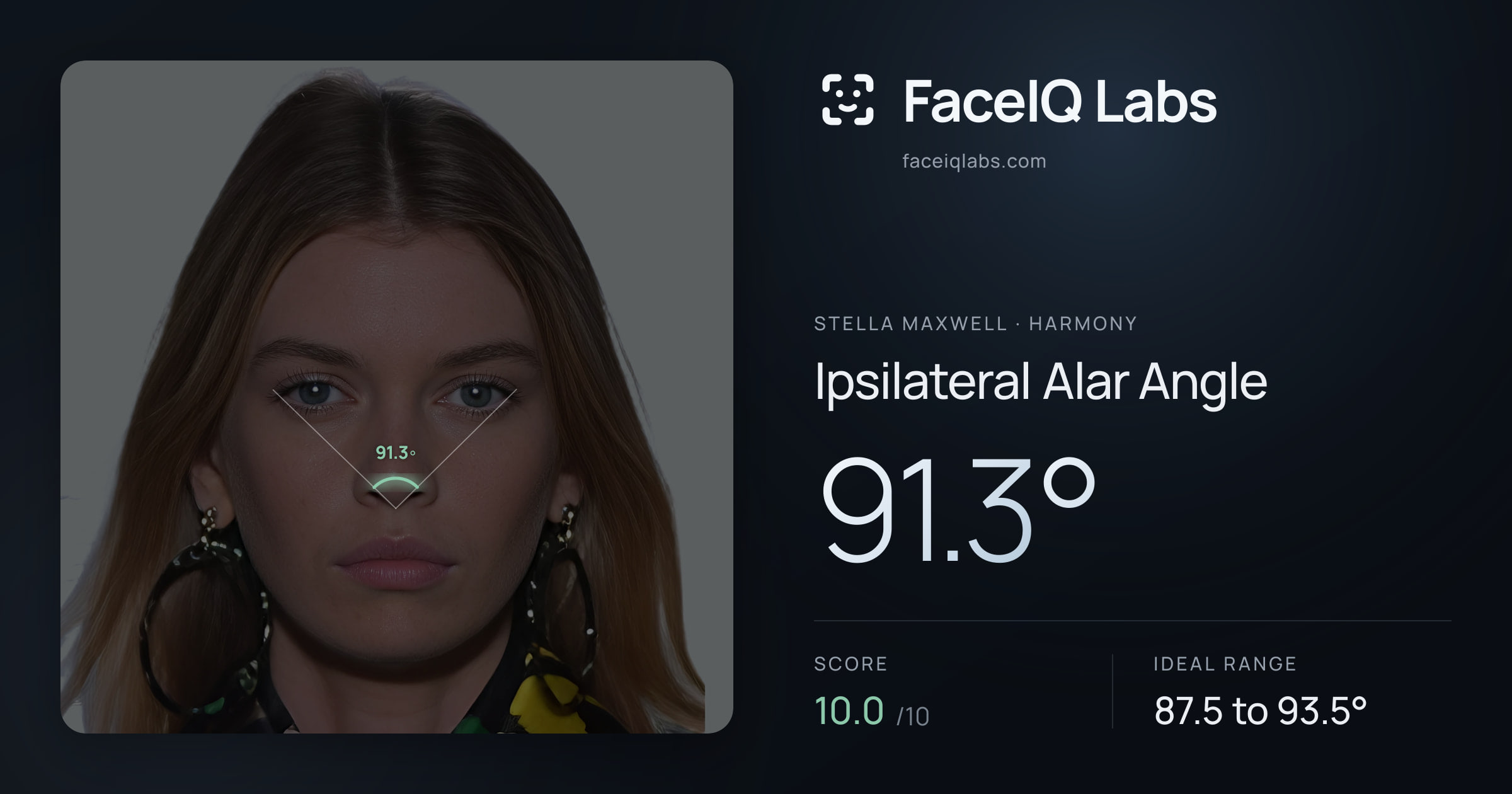 Stella Maxwell Ipsilateral Alar Angle: 91.3°, drawn on the photo