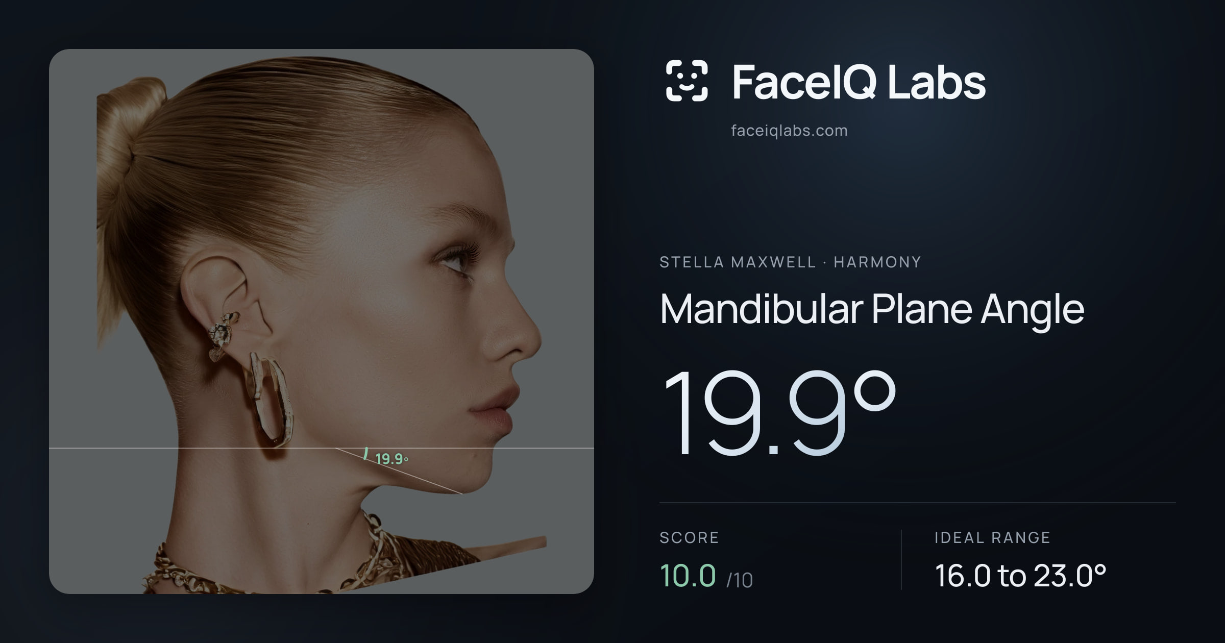 Stella Maxwell Mandibular Plane Angle: 19.9°, drawn on the photo