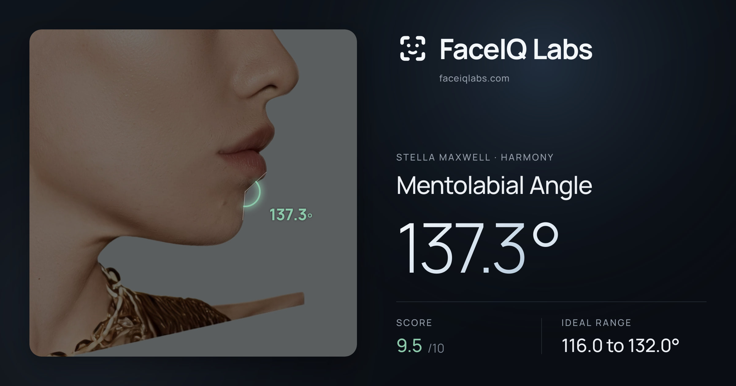 Stella Maxwell Mentolabial Angle: 137.3°, drawn on the photo