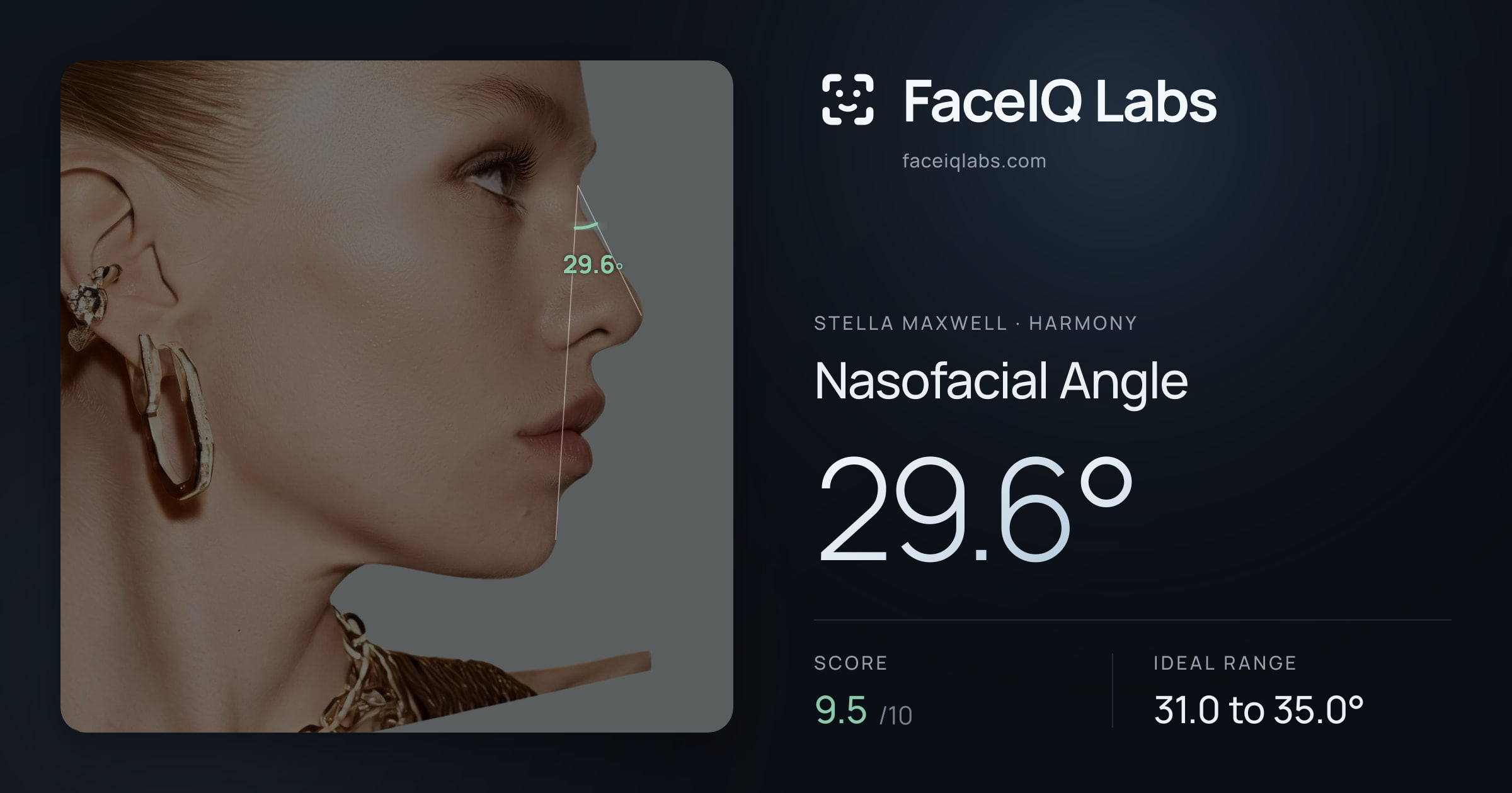 Stella Maxwell Nasofacial Angle: 29.6°, drawn on the photo