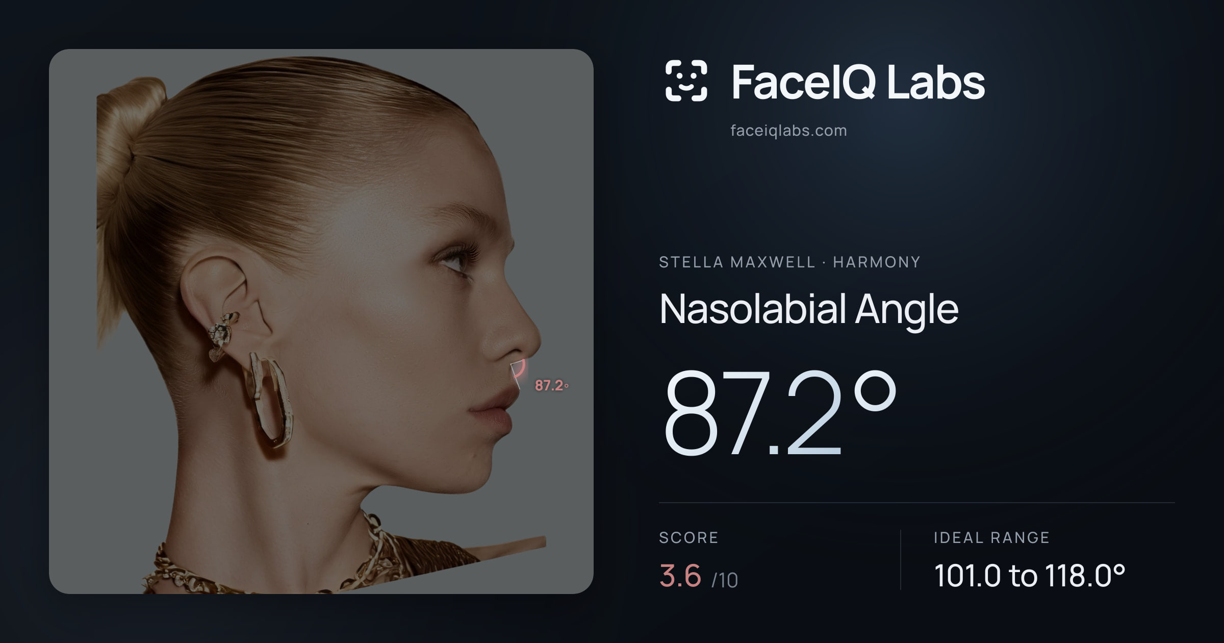 Stella Maxwell Nasolabial Angle: 87.2°, drawn on the photo
