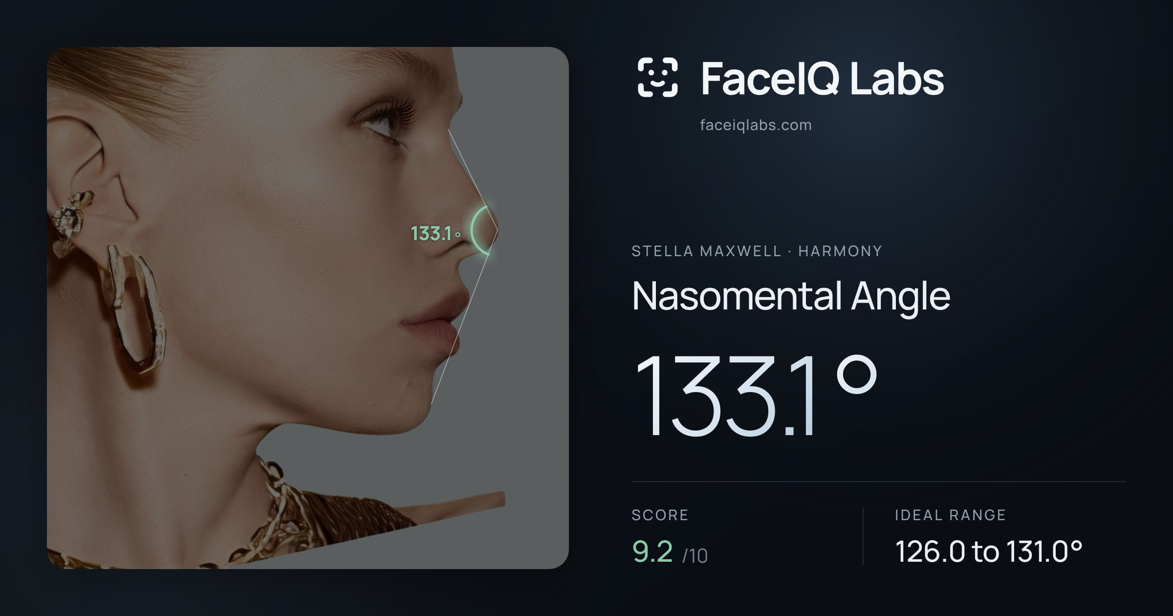 Stella Maxwell Nasomental Angle: 133.1°, drawn on the photo