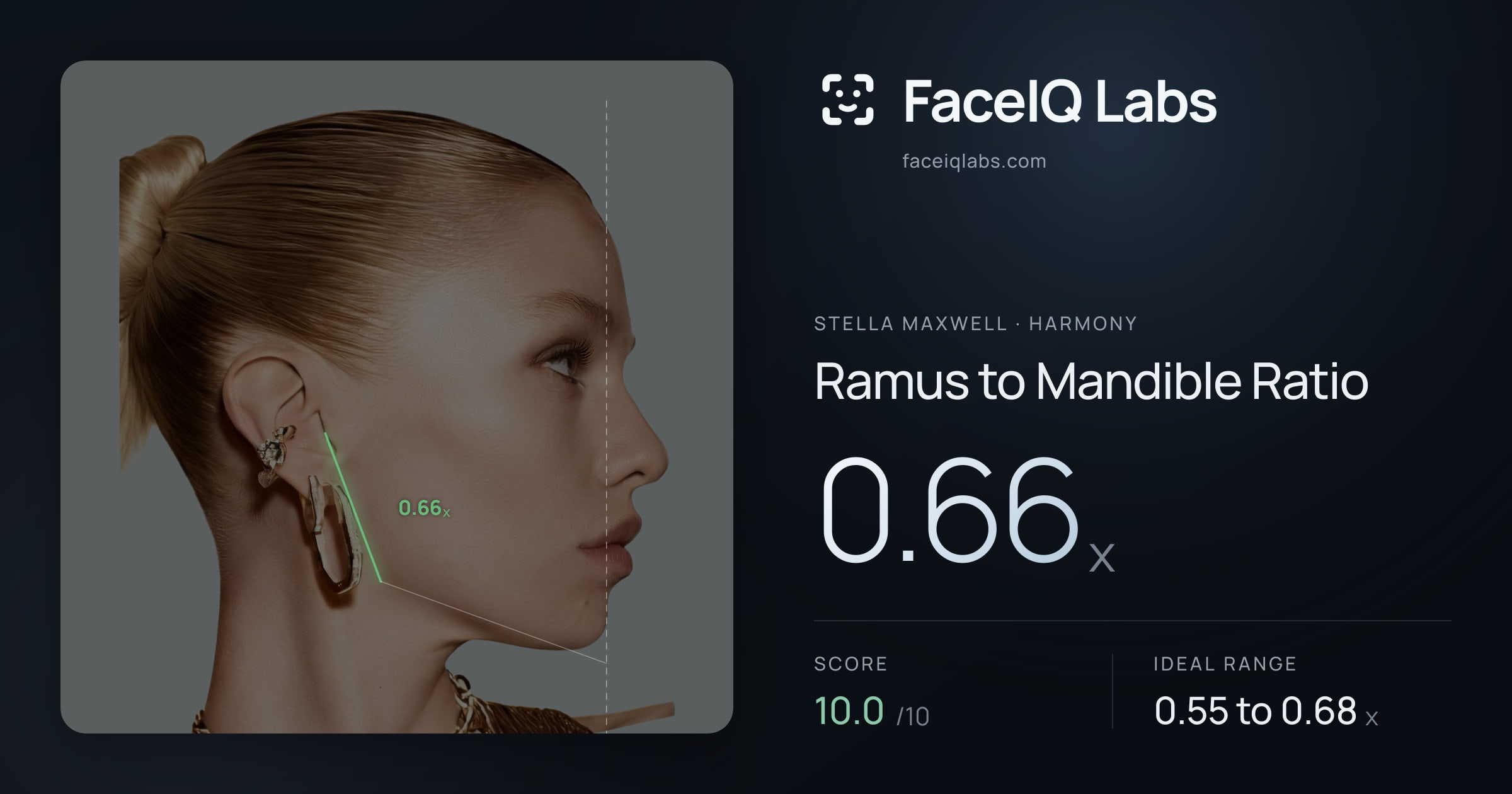Stella Maxwell Ramus to Mandible Ratio: 0.66x, drawn on the photo