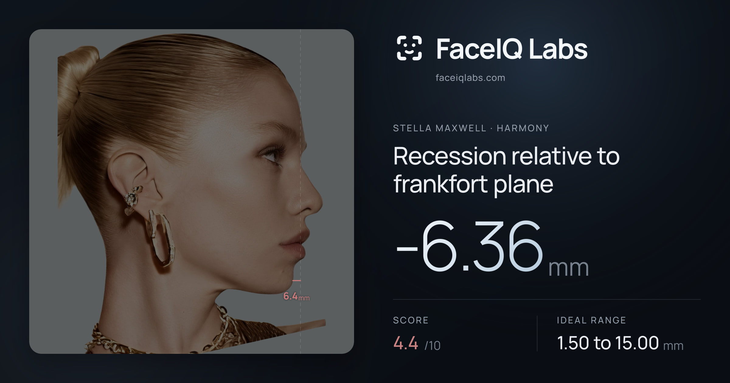 Stella Maxwell Recession relative to frankfort plane: -6.36mm, drawn on the photo