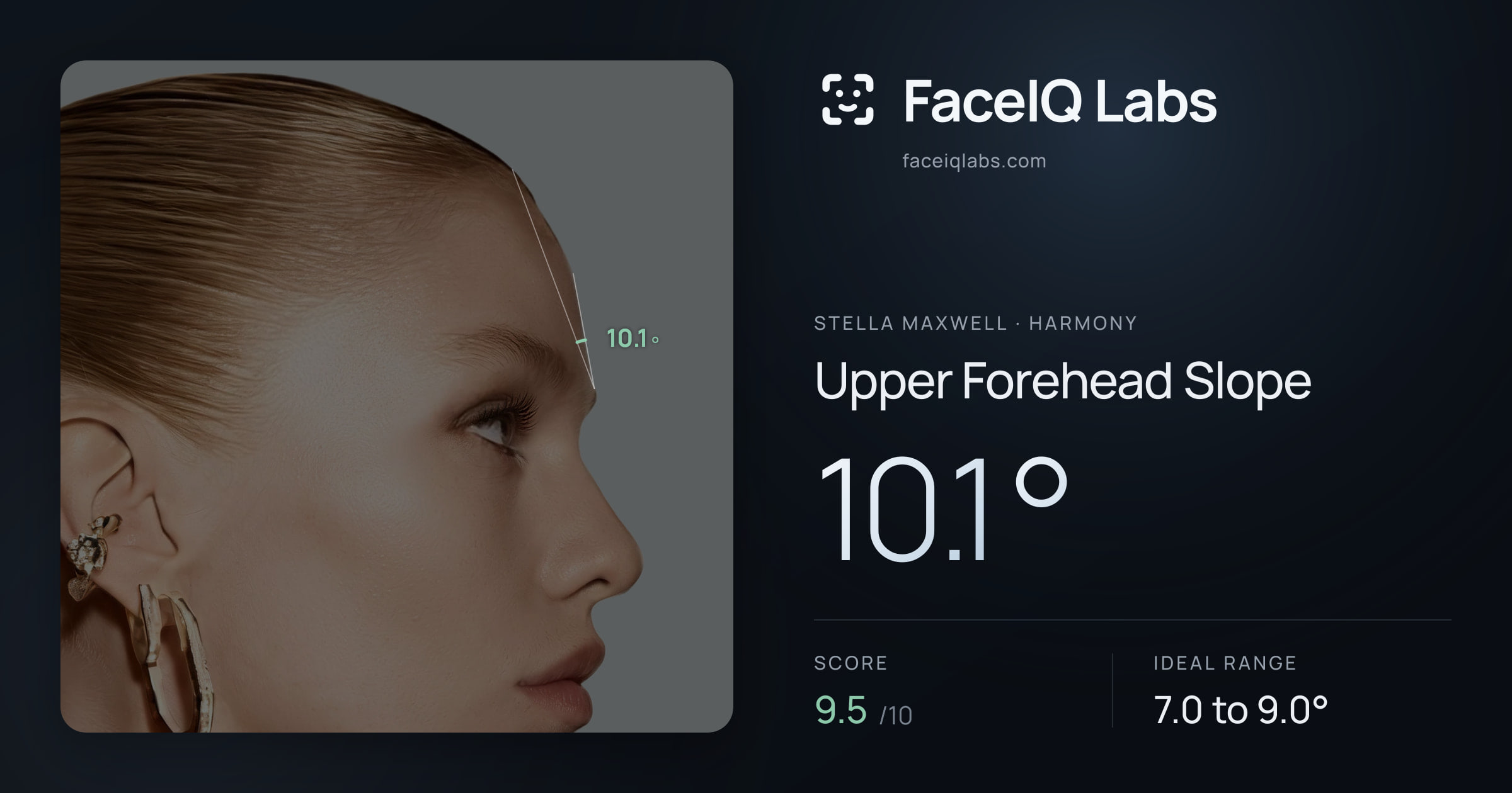 Stella Maxwell Upper Forehead Slope: 10.1°, drawn on the photo