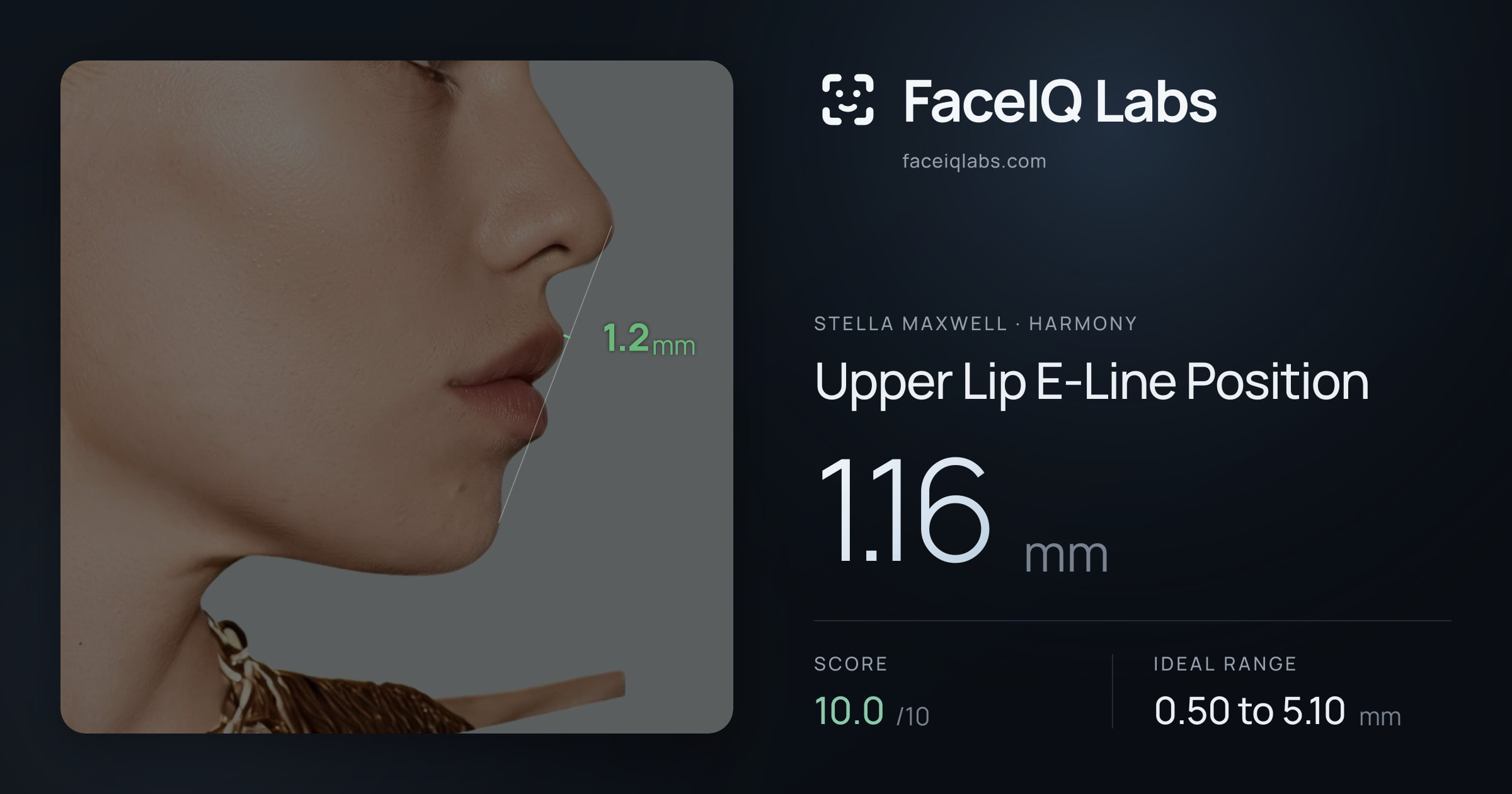 Stella Maxwell Upper Lip E-Line Position: 1.16mm, drawn on the photo
