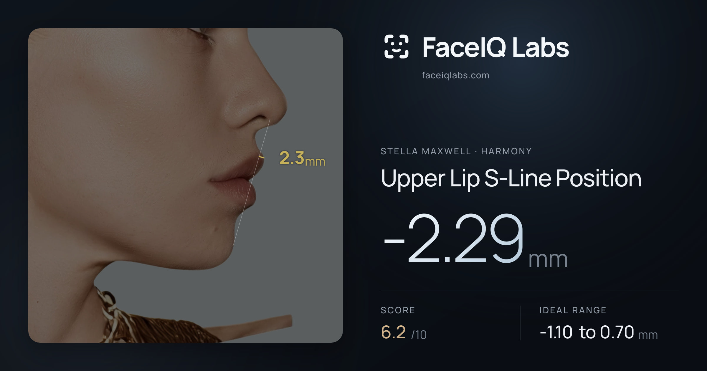 Stella Maxwell Upper Lip S-Line Position: -2.29mm, drawn on the photo