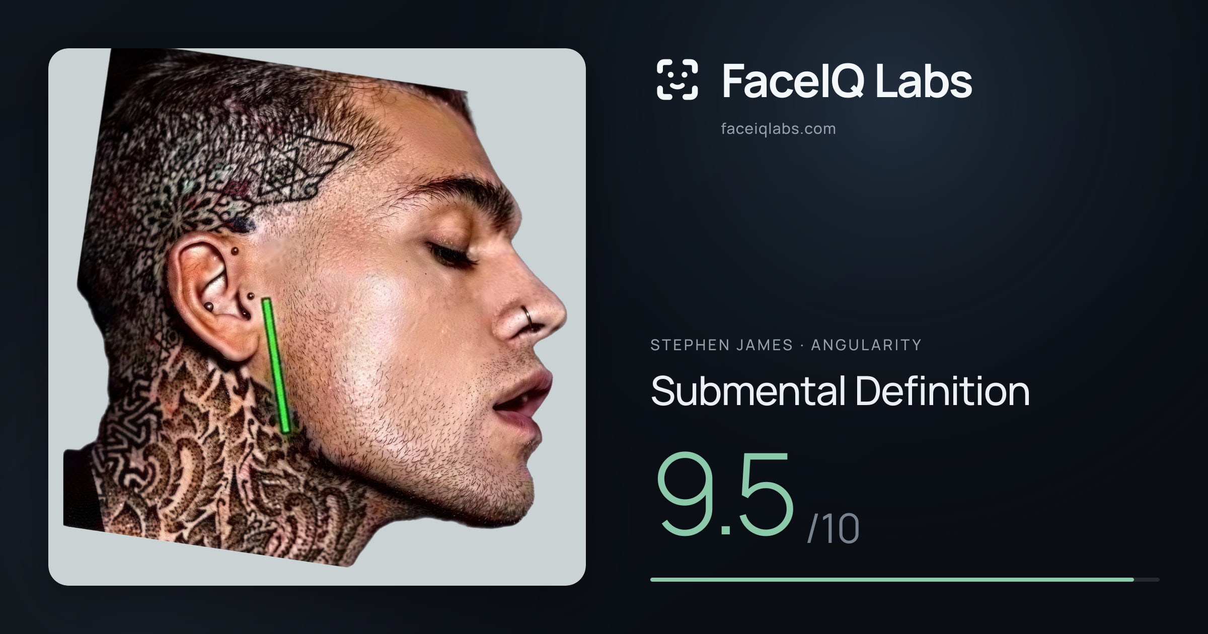 Stephen James Submental Definition: 9.5/10, drawn on the photo