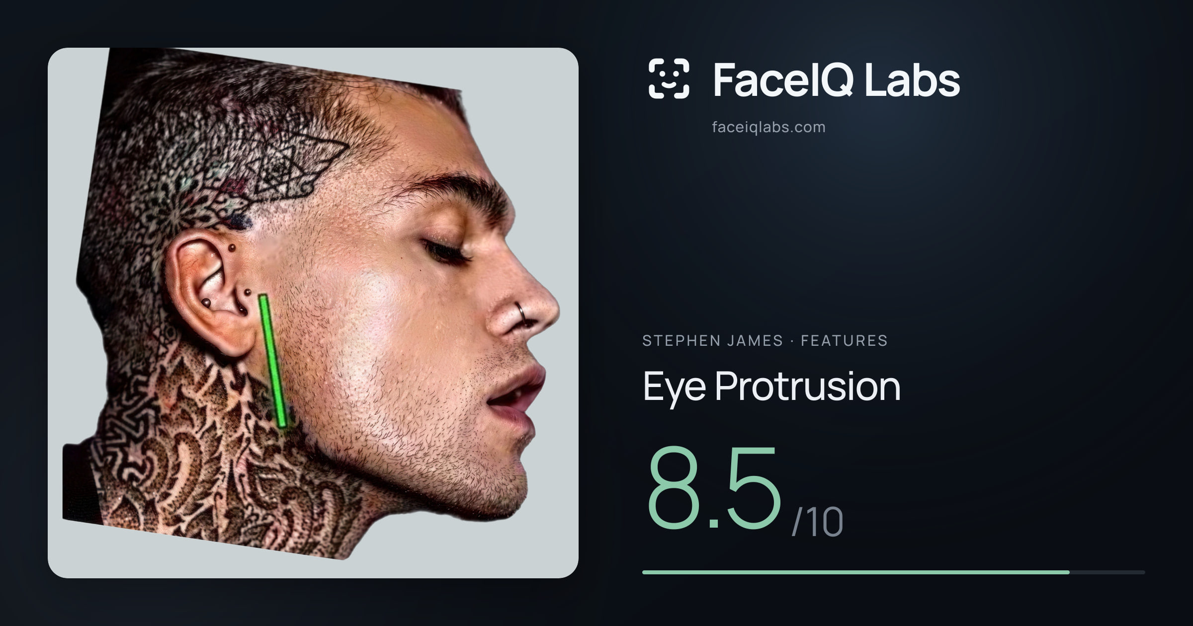 Stephen James Eye Protrusion: 8.5/10, drawn on the photo