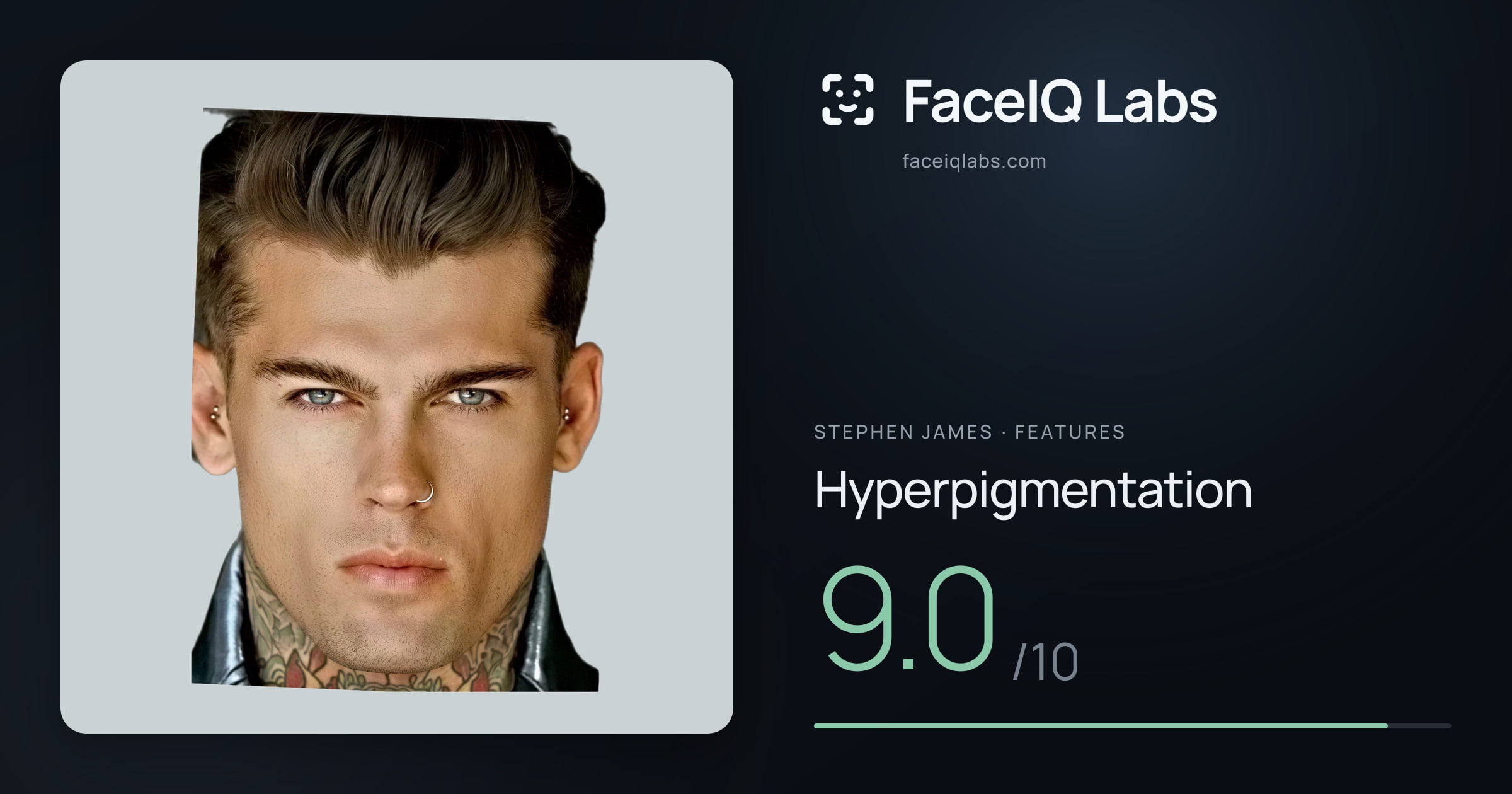 Stephen James Hyperpigmentation: 9.0/10, drawn on the photo