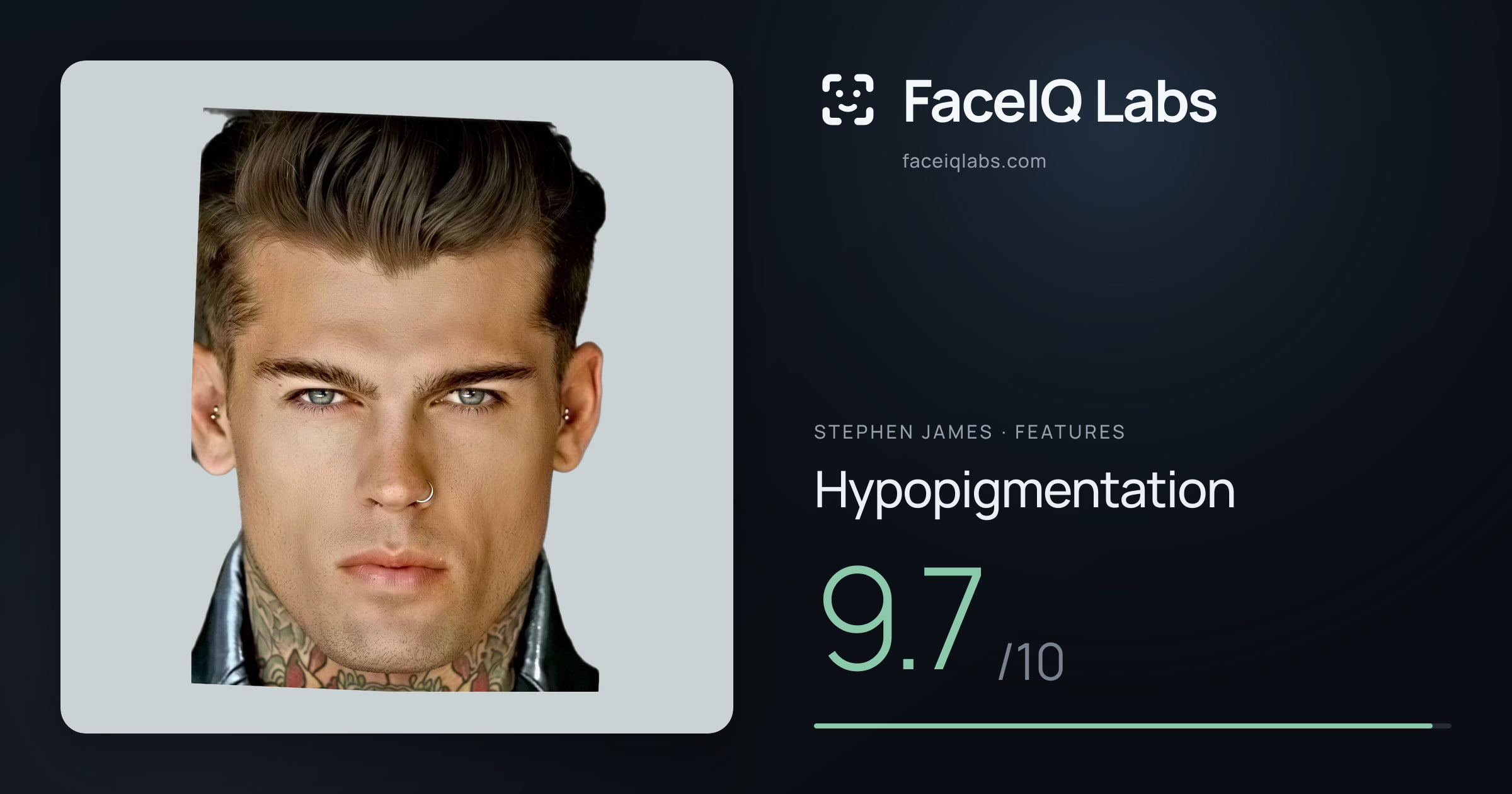 Stephen James Hypopigmentation: 9.7/10, drawn on the photo