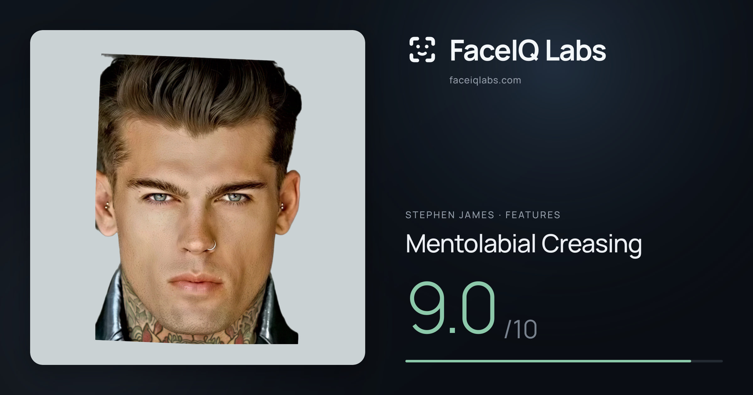 Stephen James Mentolabial Creasing: 9.0/10, drawn on the photo