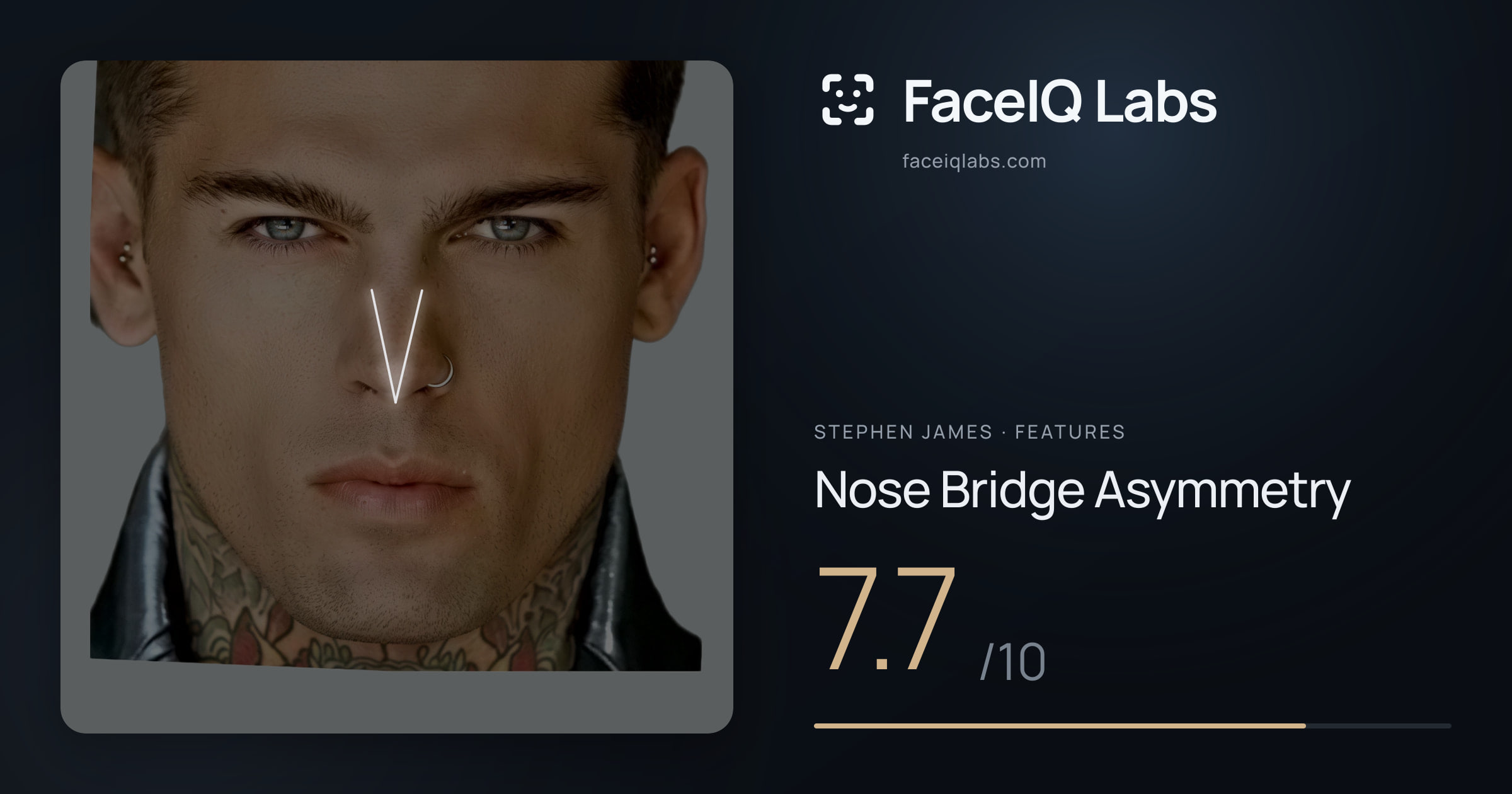 Stephen James Nose Bridge Asymmetry: 7.7/10, drawn on the photo