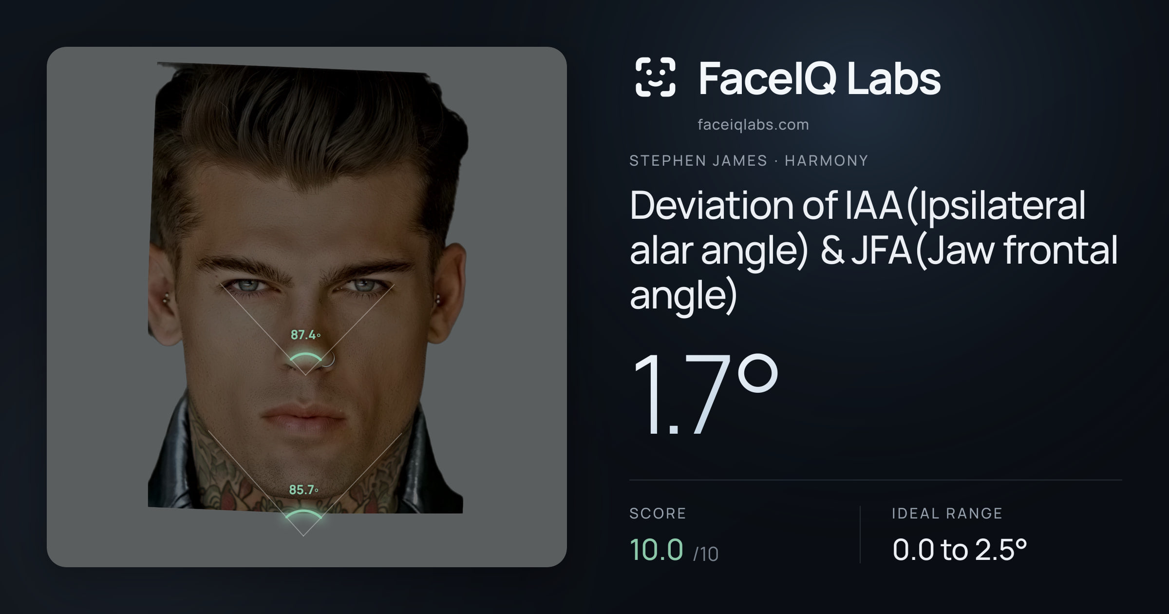 Stephen James Deviation of IAA(Ipsilateral alar angle) & JFA(Jaw frontal angle): 1.7°, drawn on the photo