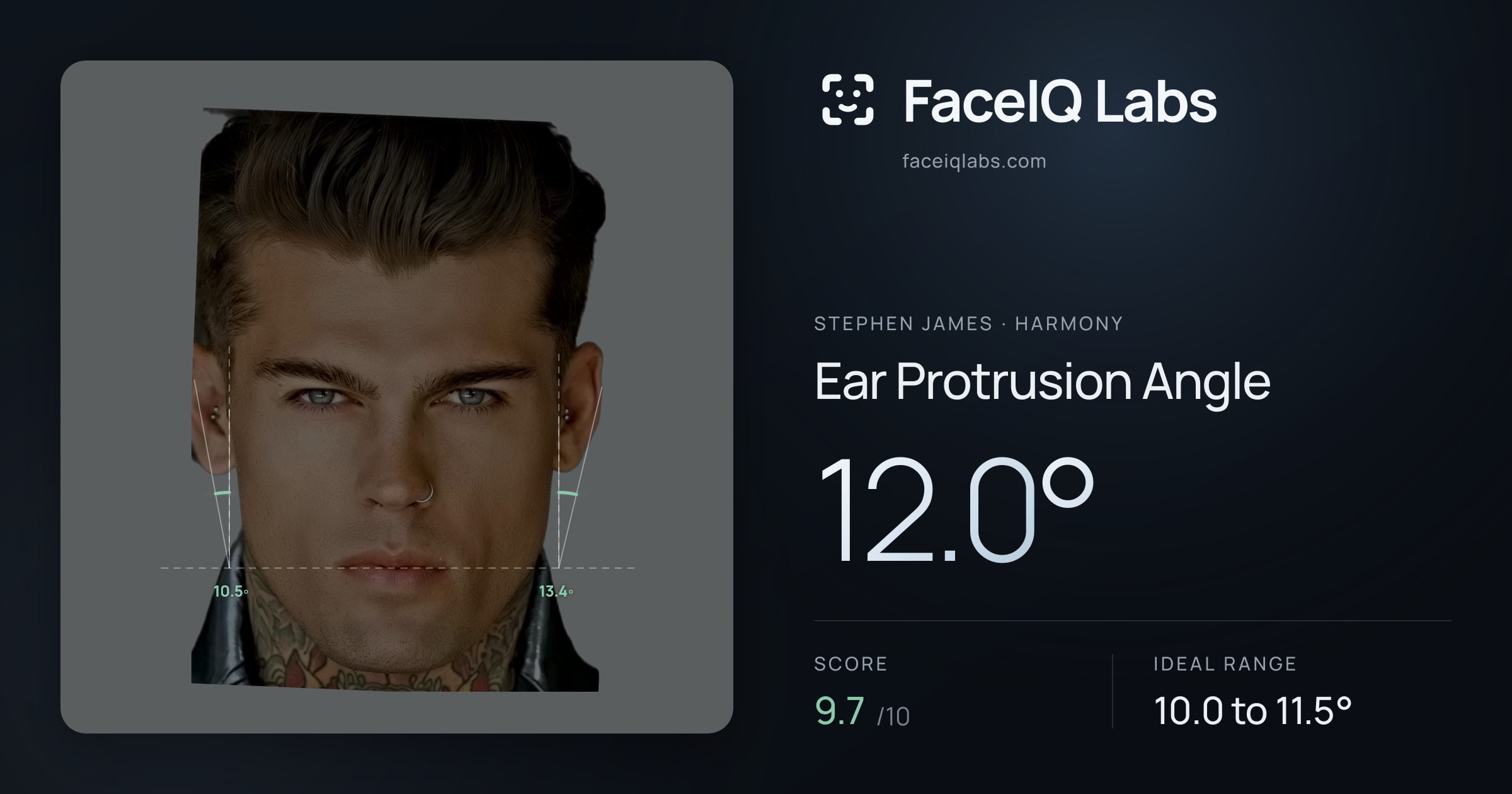 Stephen James Ear Protrusion Angle: 12.0°, drawn on the photo