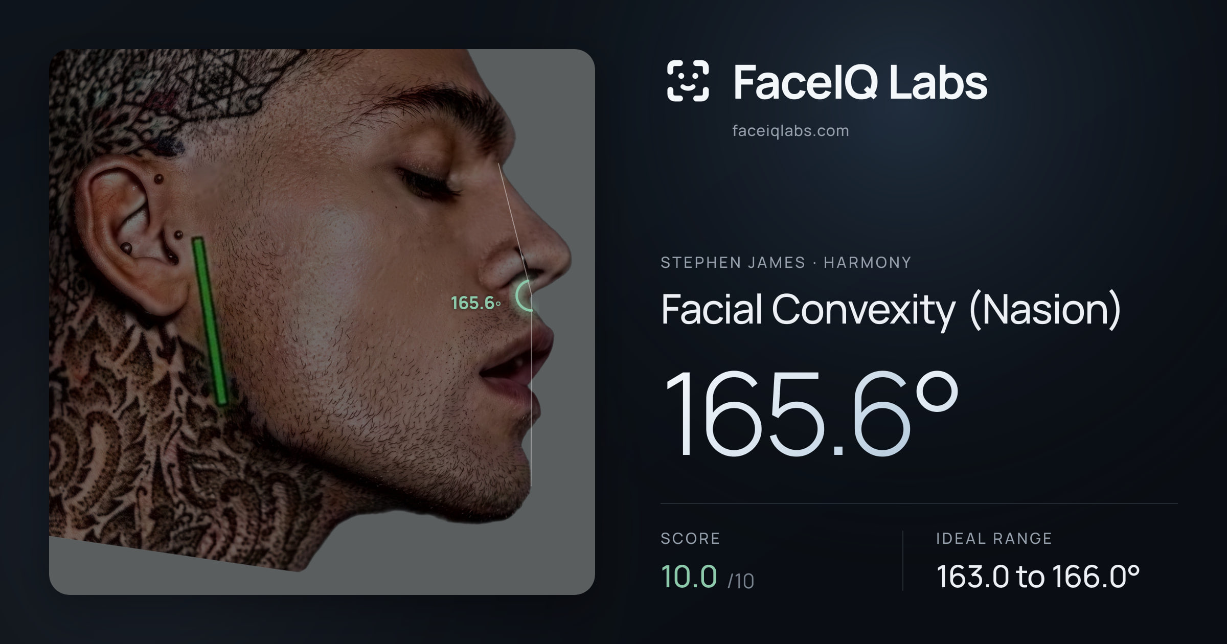 Stephen James Facial Convexity (Nasion): 165.6°, drawn on the photo