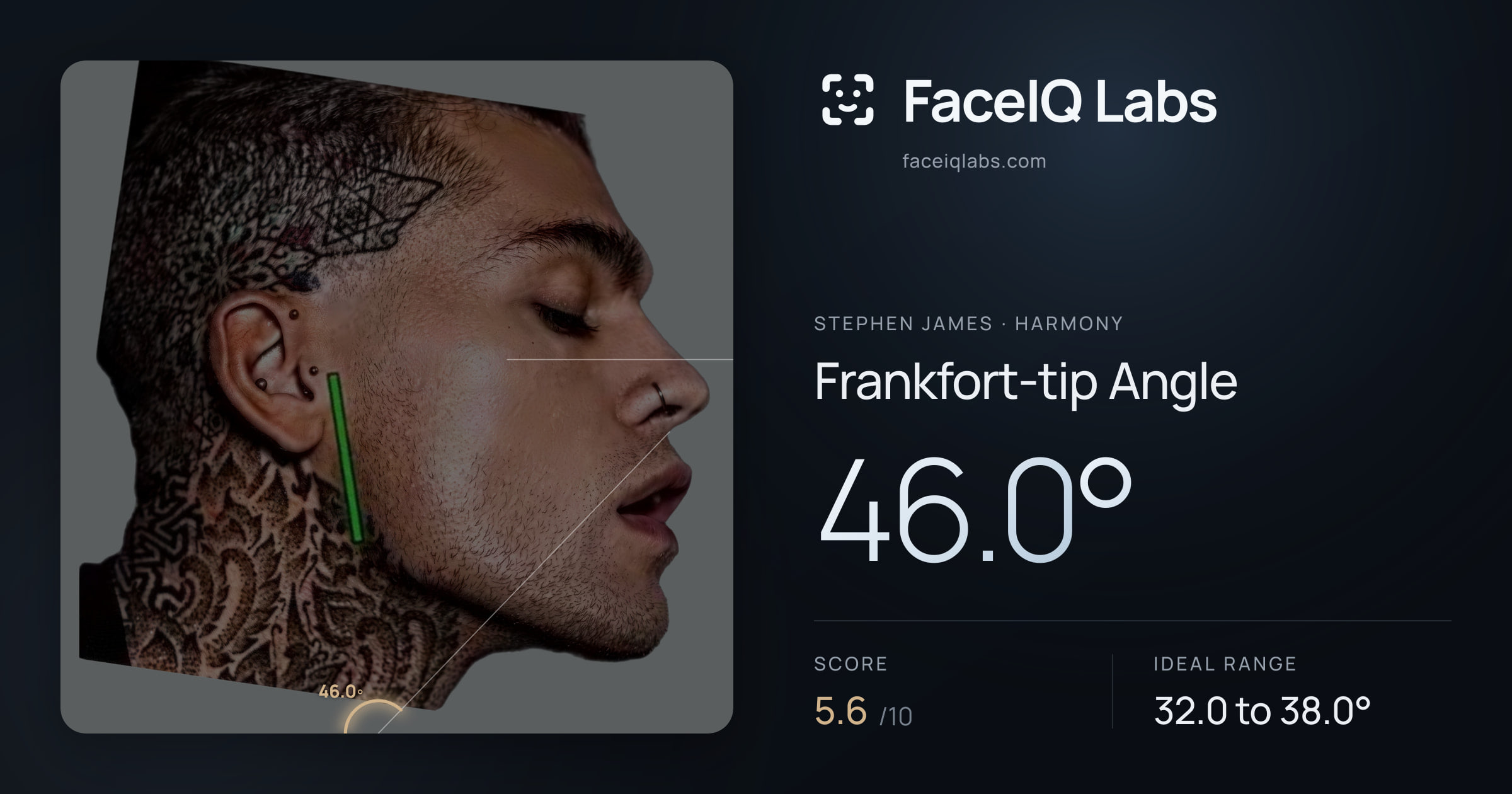 Stephen James Frankfort-tip Angle: 46.0°, drawn on the photo