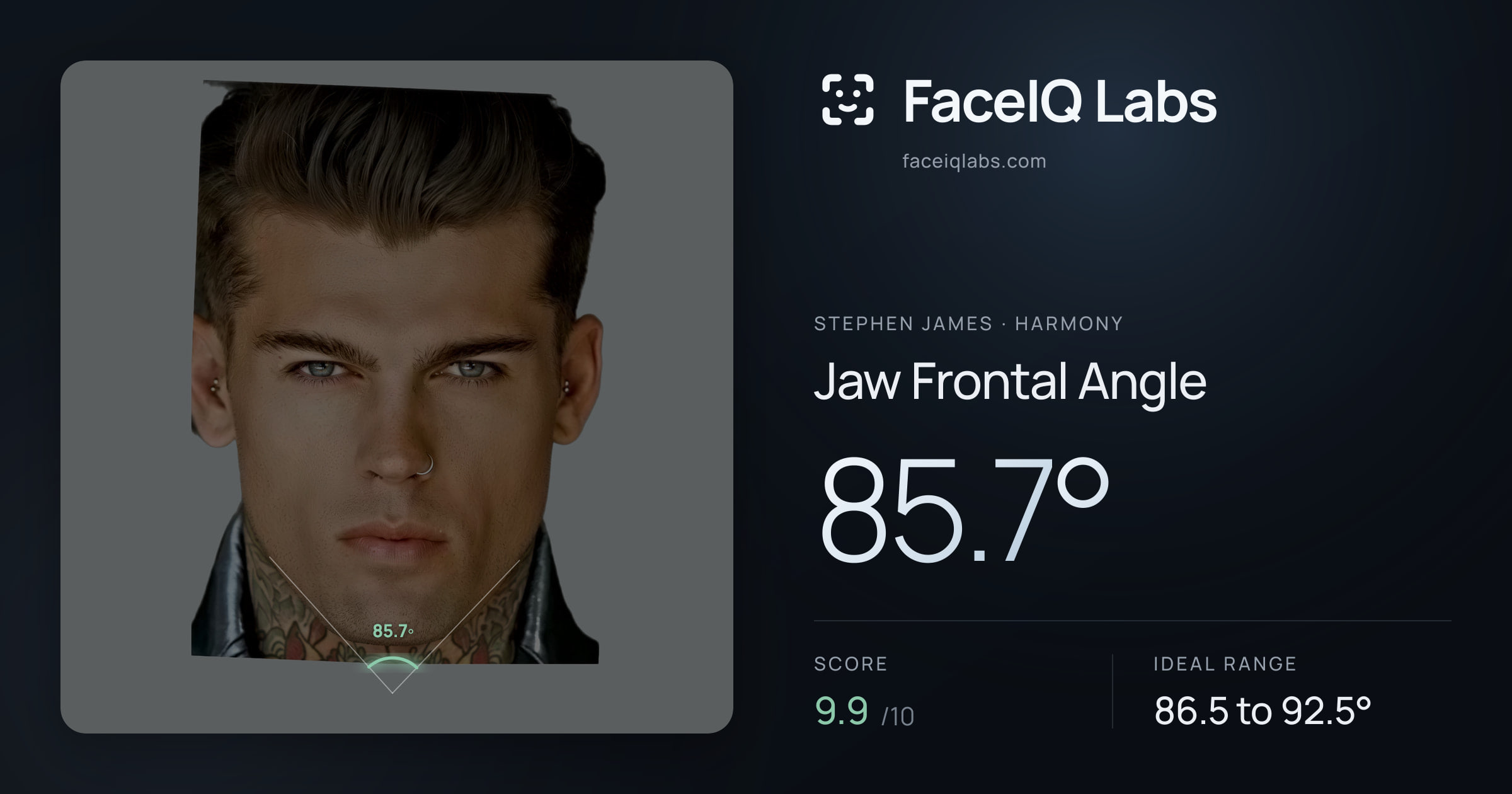 Stephen James Jaw Frontal Angle: 85.7°, drawn on the photo