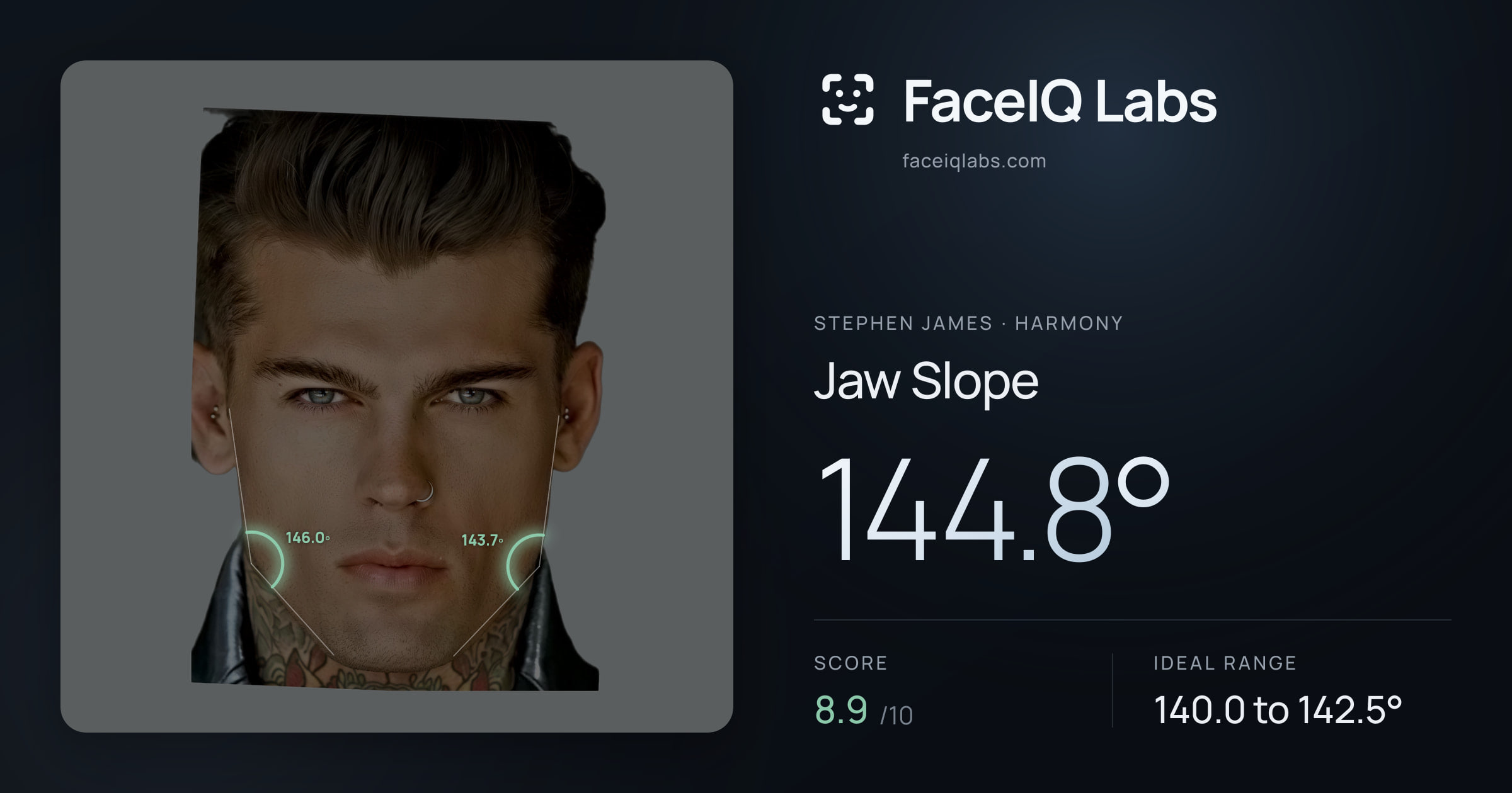 Stephen James Jaw Slope: 144.8°, drawn on the photo
