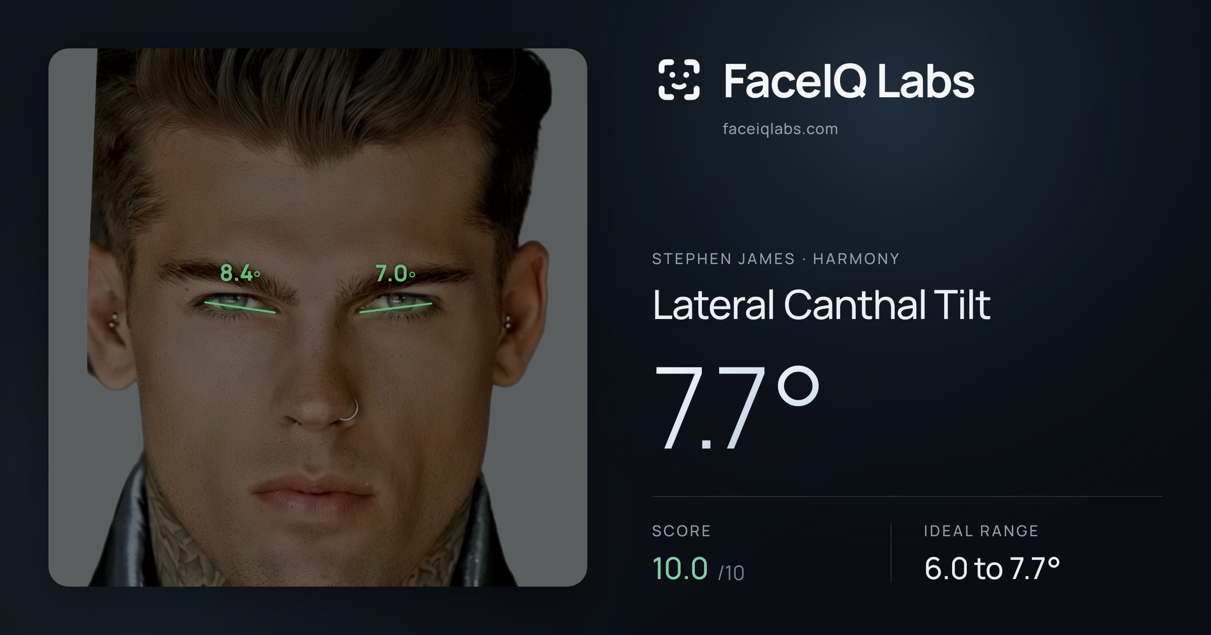Stephen James Lateral Canthal Tilt: 7.7°, drawn on the photo