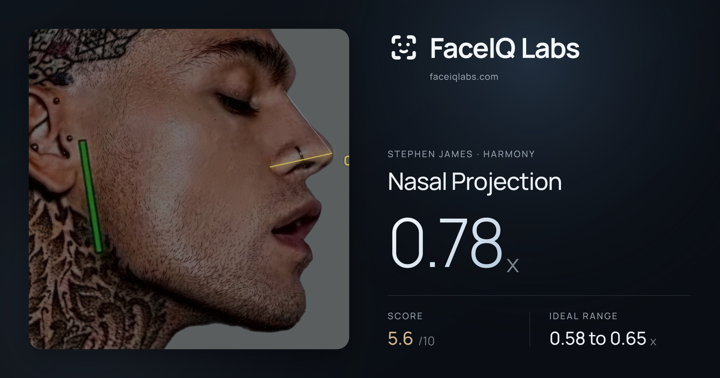 Stephen James Nasal Projection: 0.78x, drawn on the photo