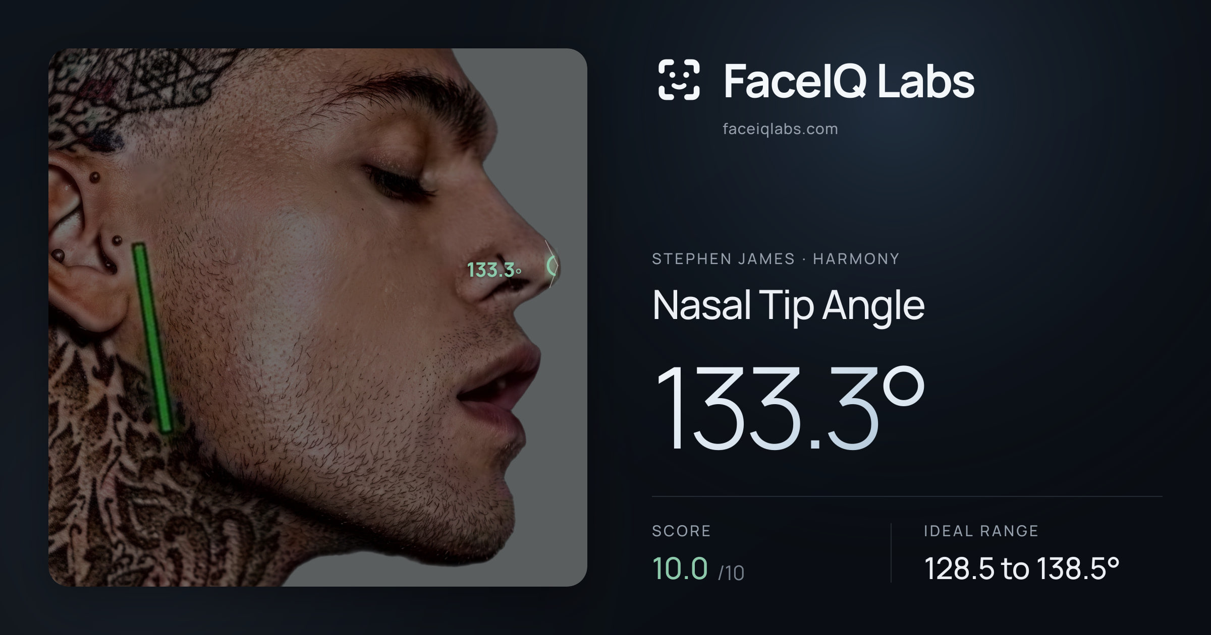 Stephen James Nasal Tip Angle: 133.3°, drawn on the photo