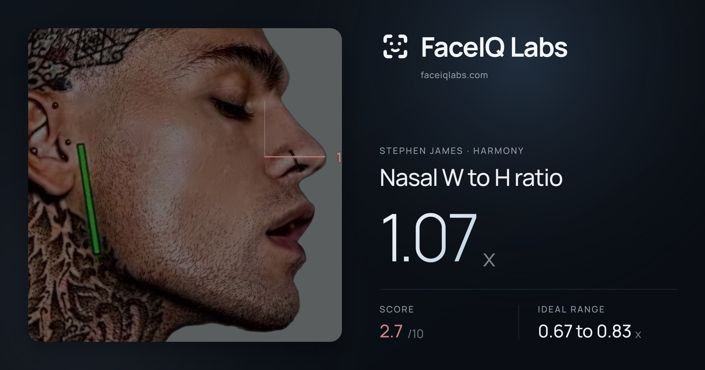 Stephen James Nasal W to H ratio: 1.07x, drawn on the photo