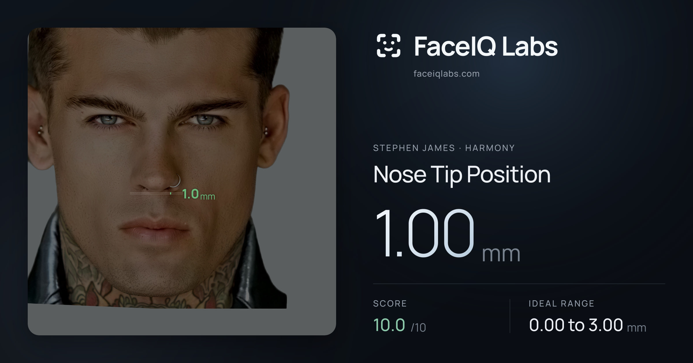 Stephen James Nose Tip Position: 1.00mm, drawn on the photo