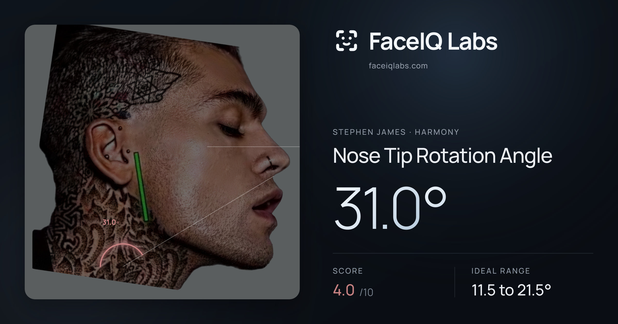 Stephen James Nose Tip Rotation Angle: 31.0°, drawn on the photo