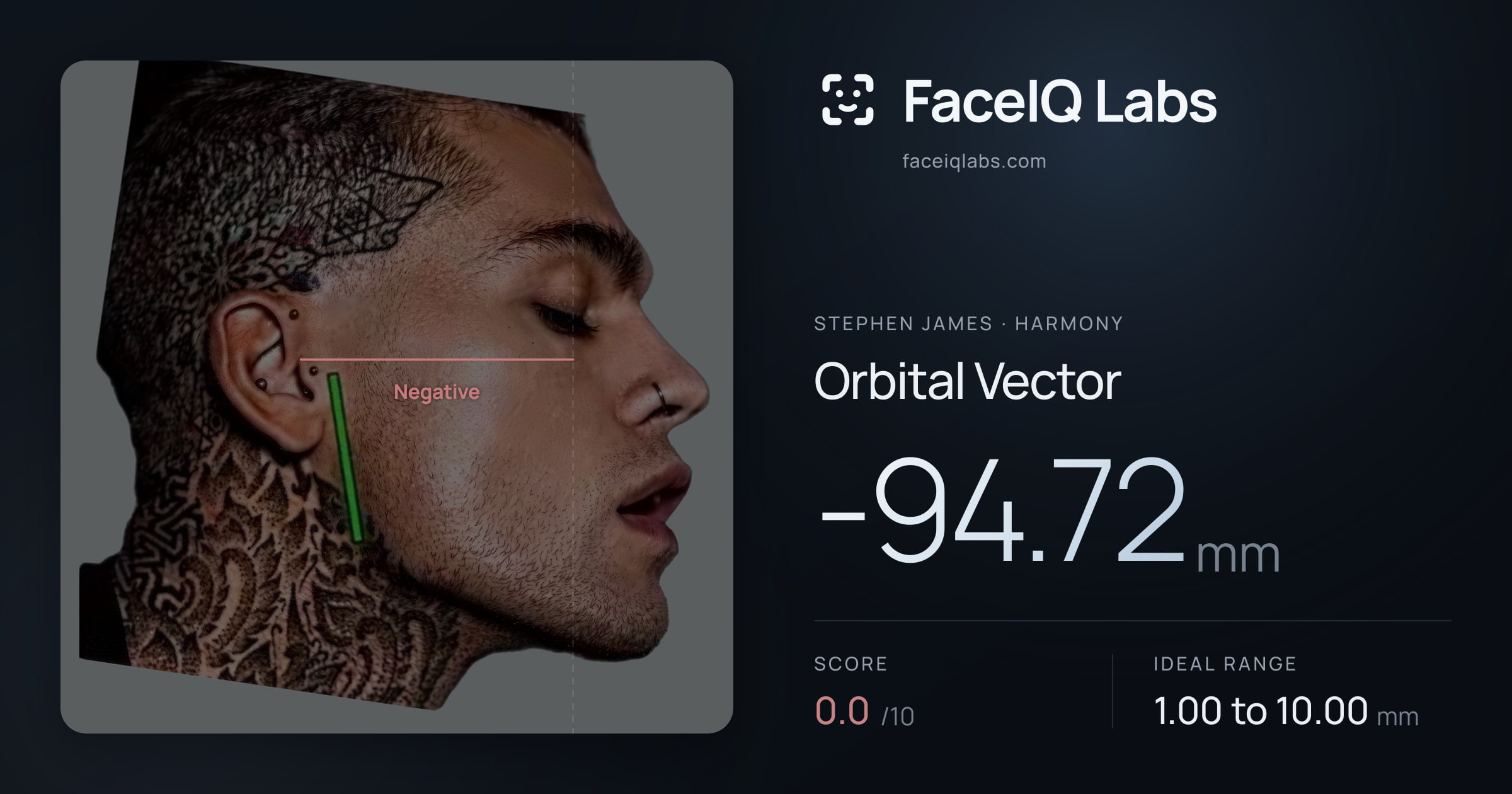 Stephen James Orbital Vector: -94.72mm, drawn on the photo
