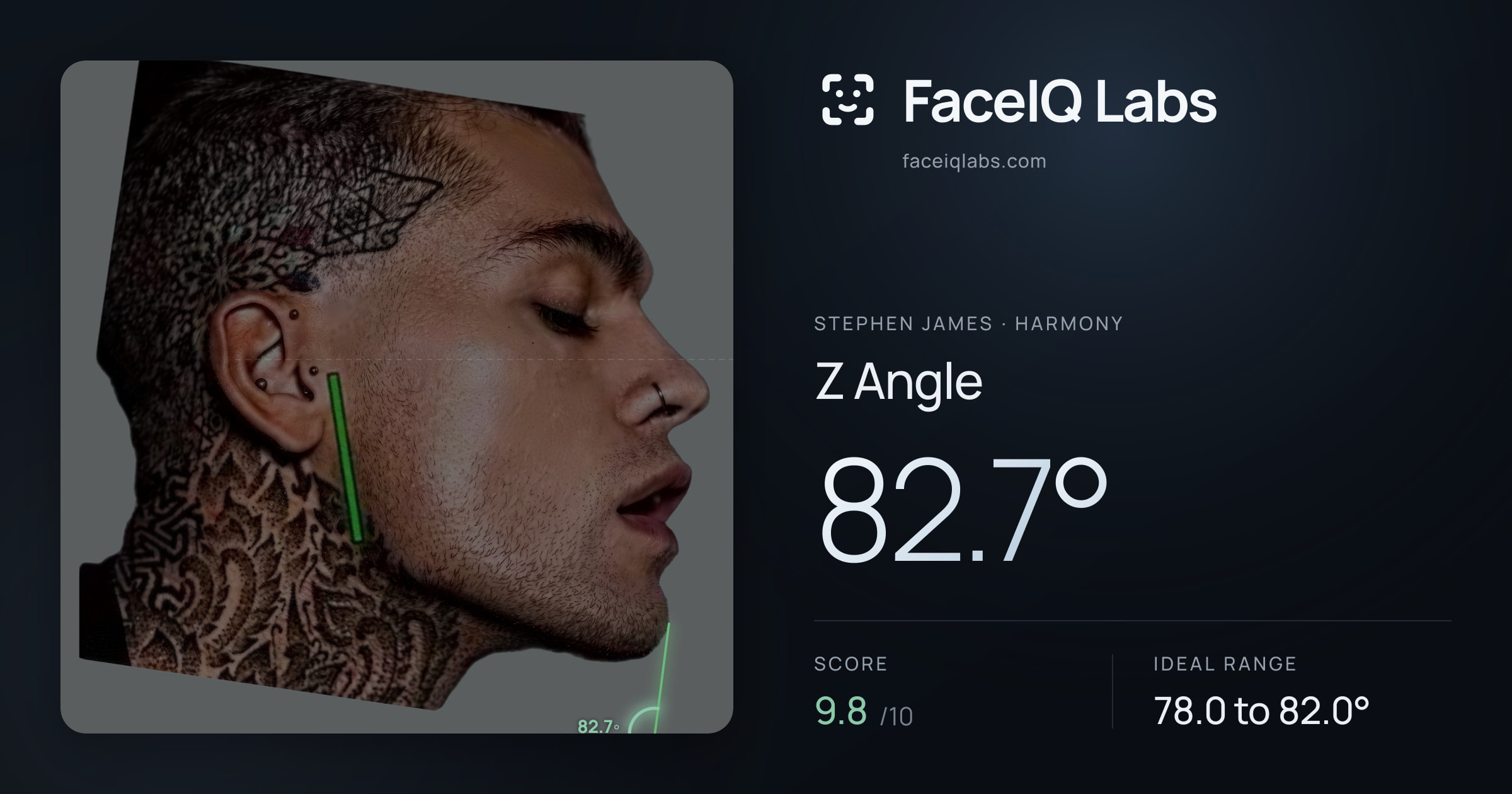 Stephen James Z Angle: 82.7°, drawn on the photo