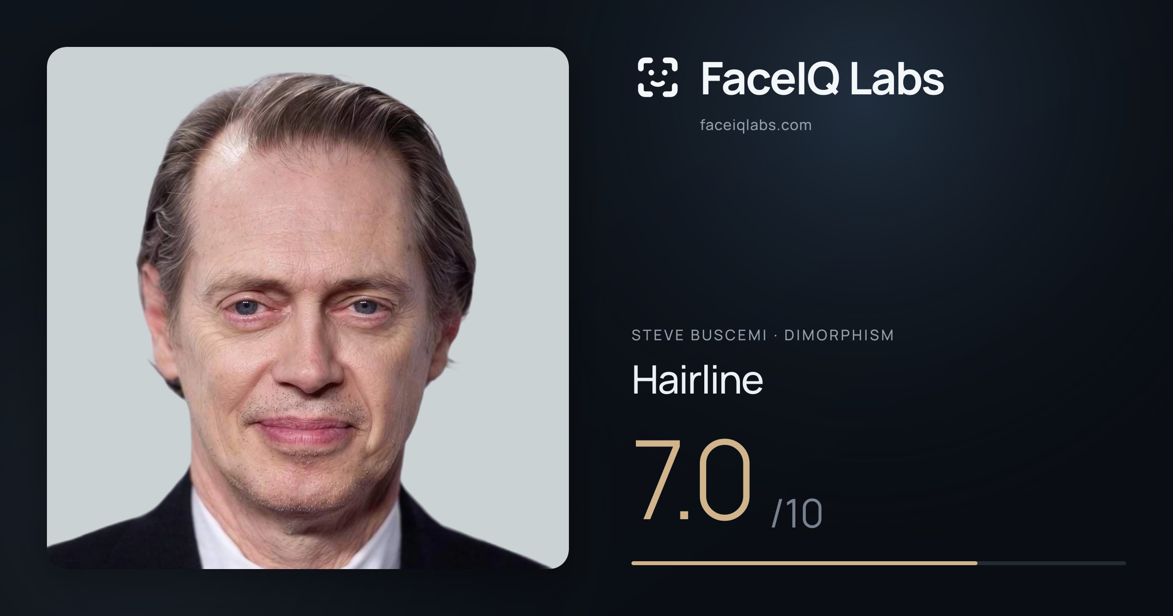 Steve Buscemi Hairline: 7.0/10, drawn on the photo