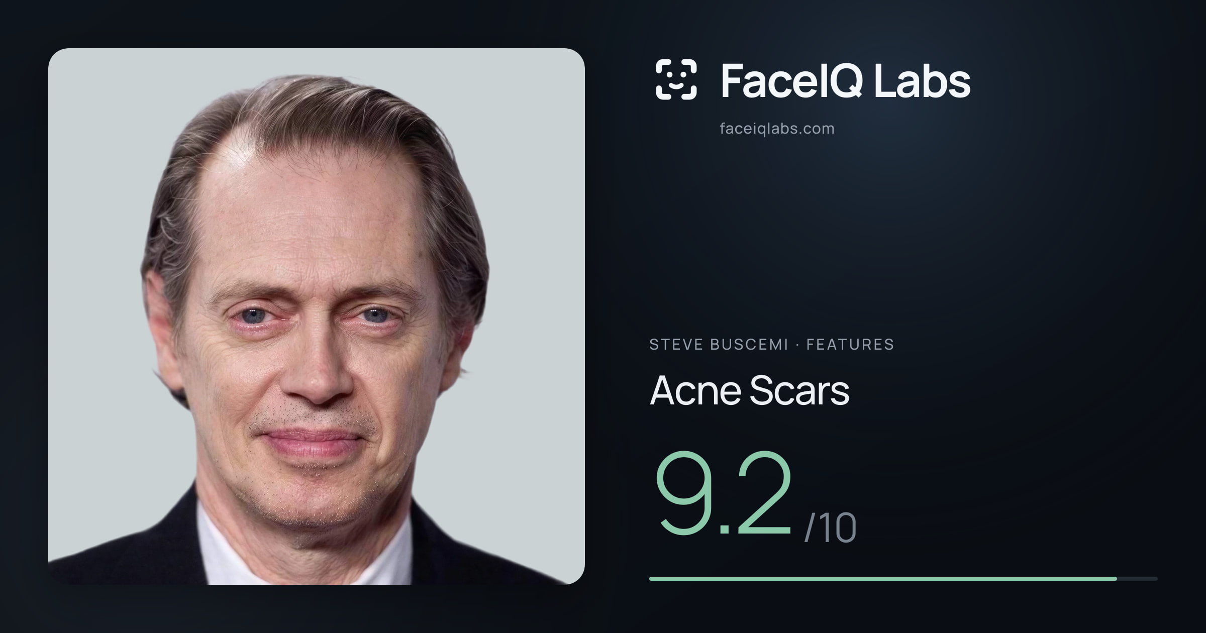 Steve Buscemi Acne Scars: 9.2/10, drawn on the photo