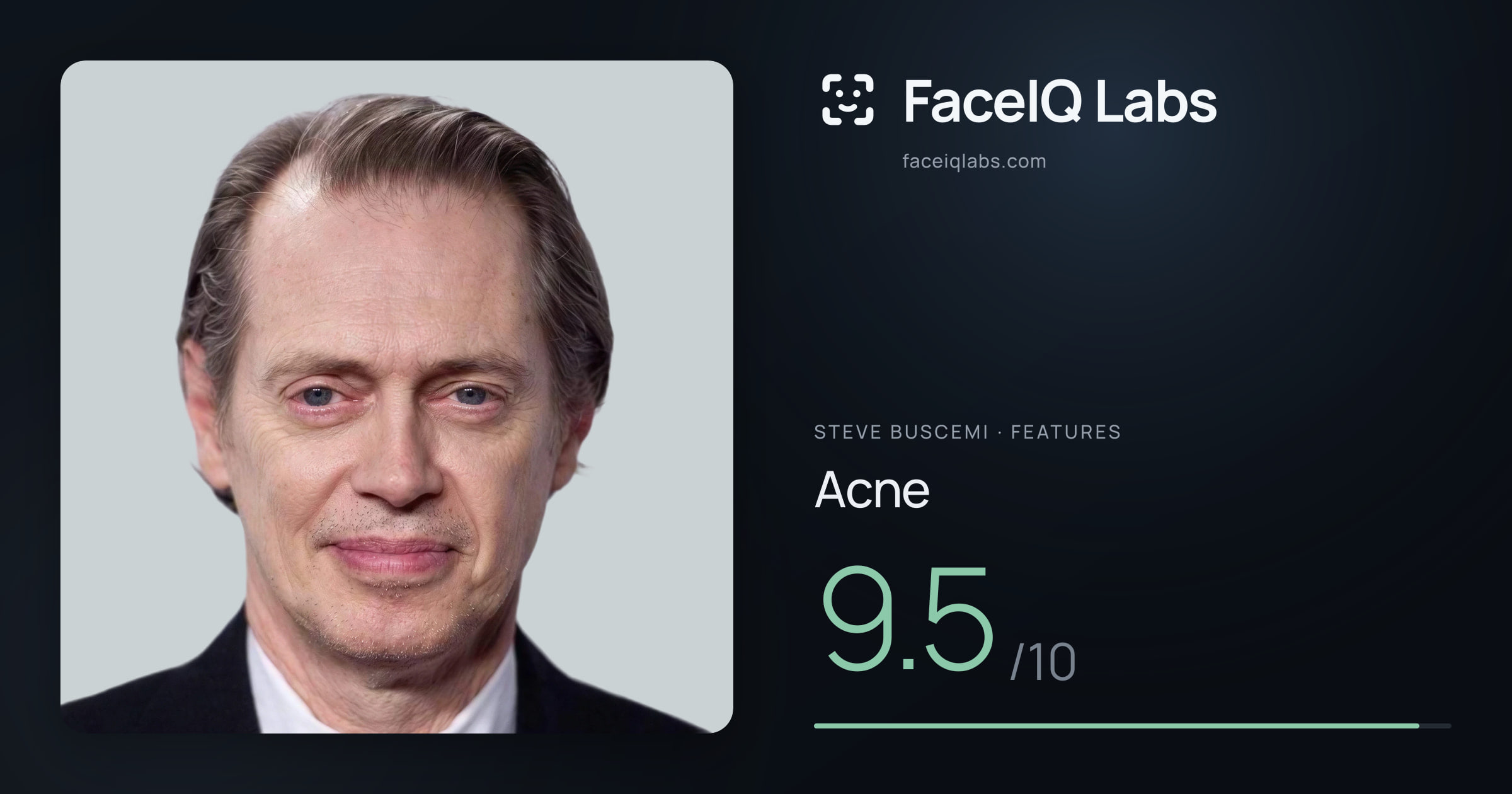 Steve Buscemi Acne: 9.5/10, drawn on the photo