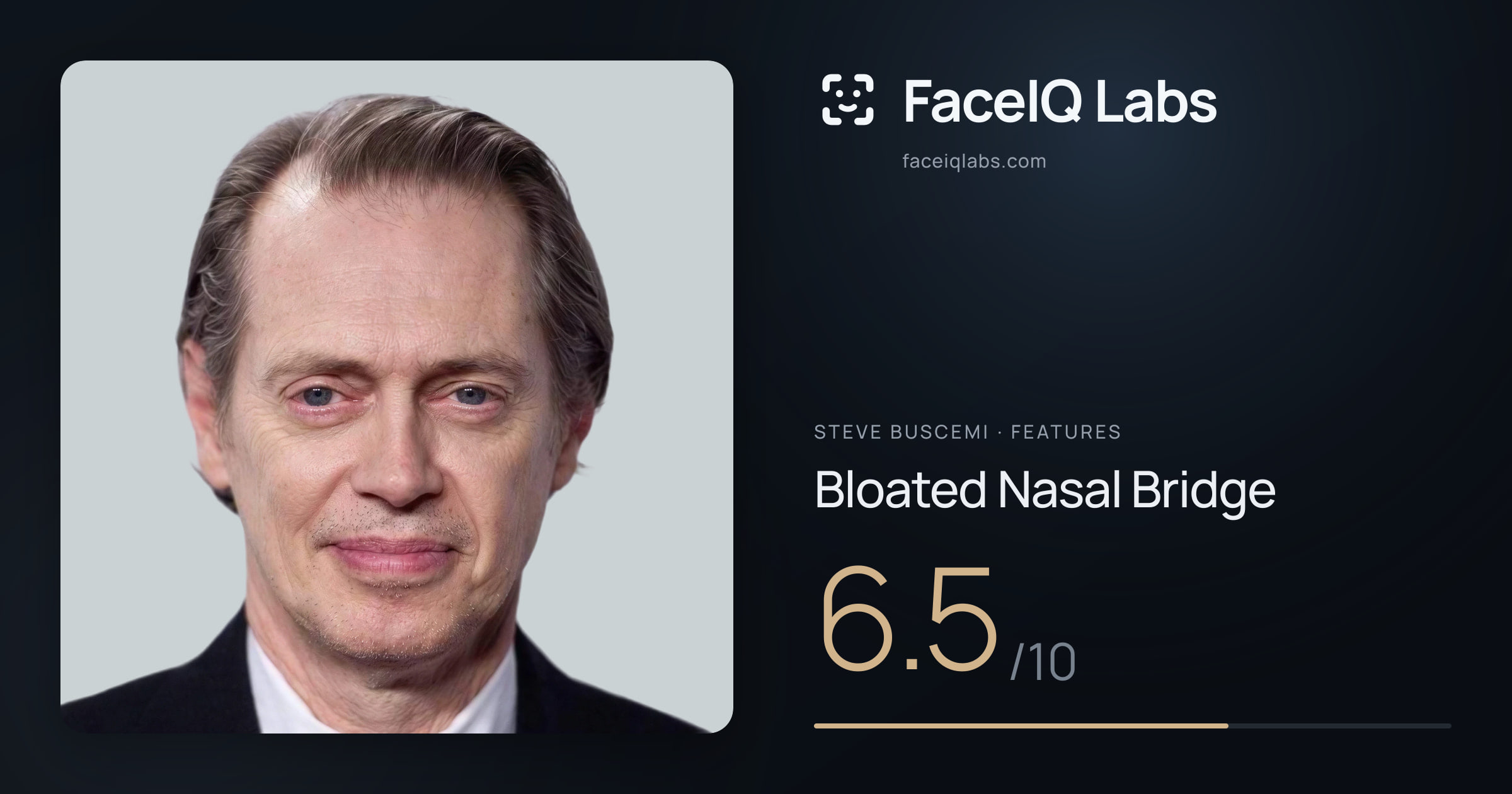 Steve Buscemi Bloated Nasal Bridge: 6.5/10, drawn on the photo