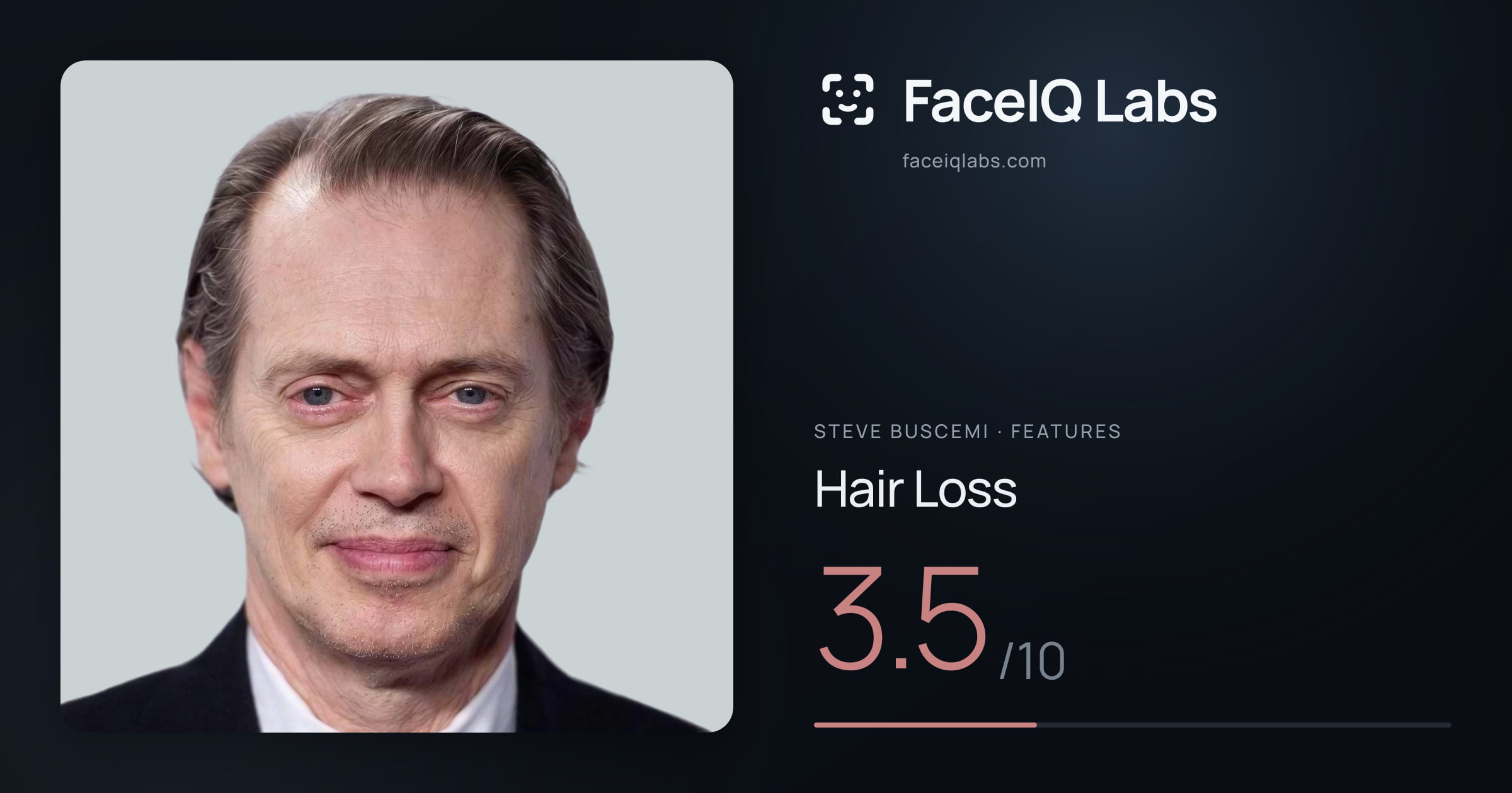 Steve Buscemi Hair Loss: 3.5/10, drawn on the photo