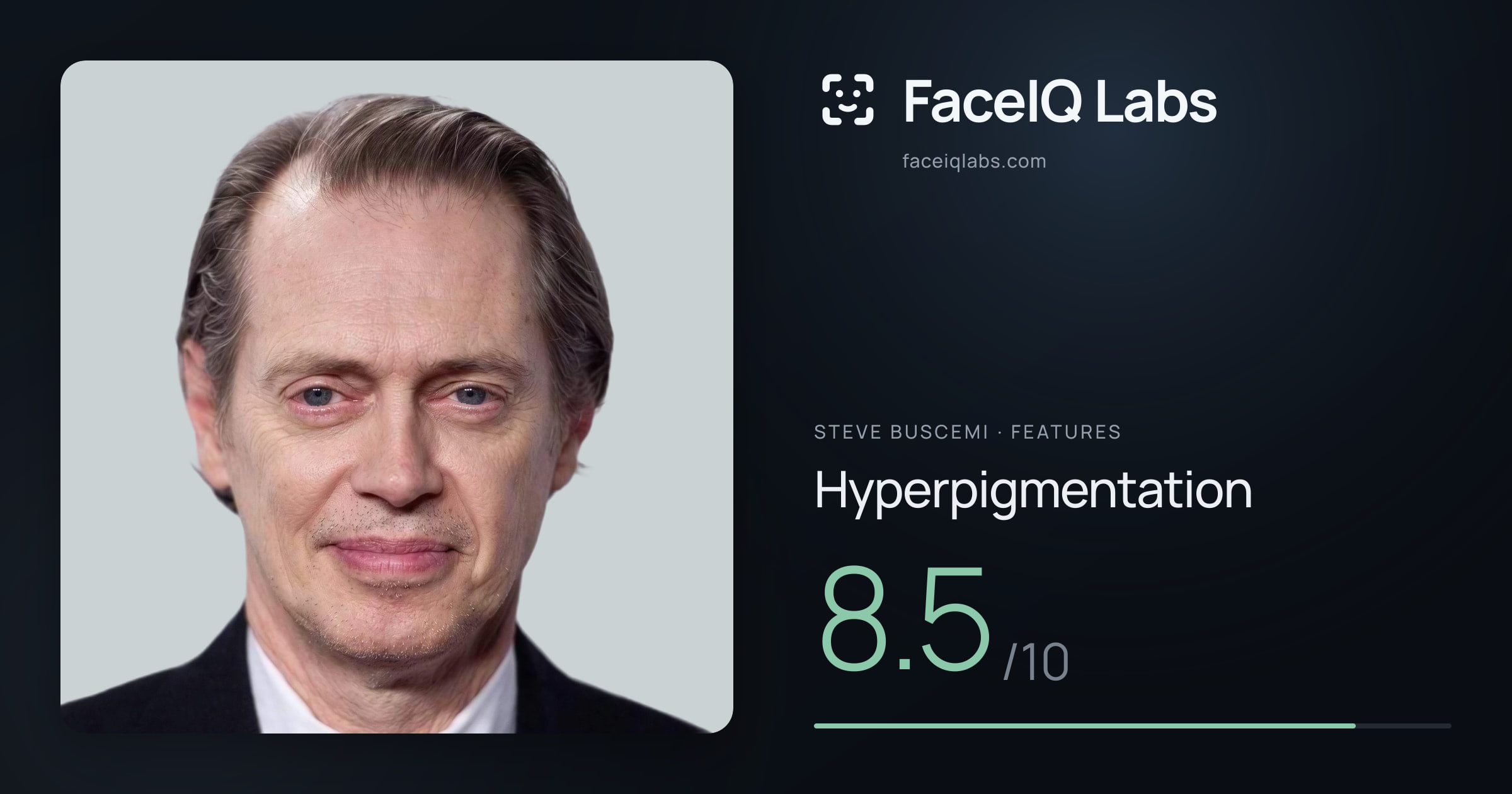 Steve Buscemi Hyperpigmentation: 8.5/10, drawn on the photo
