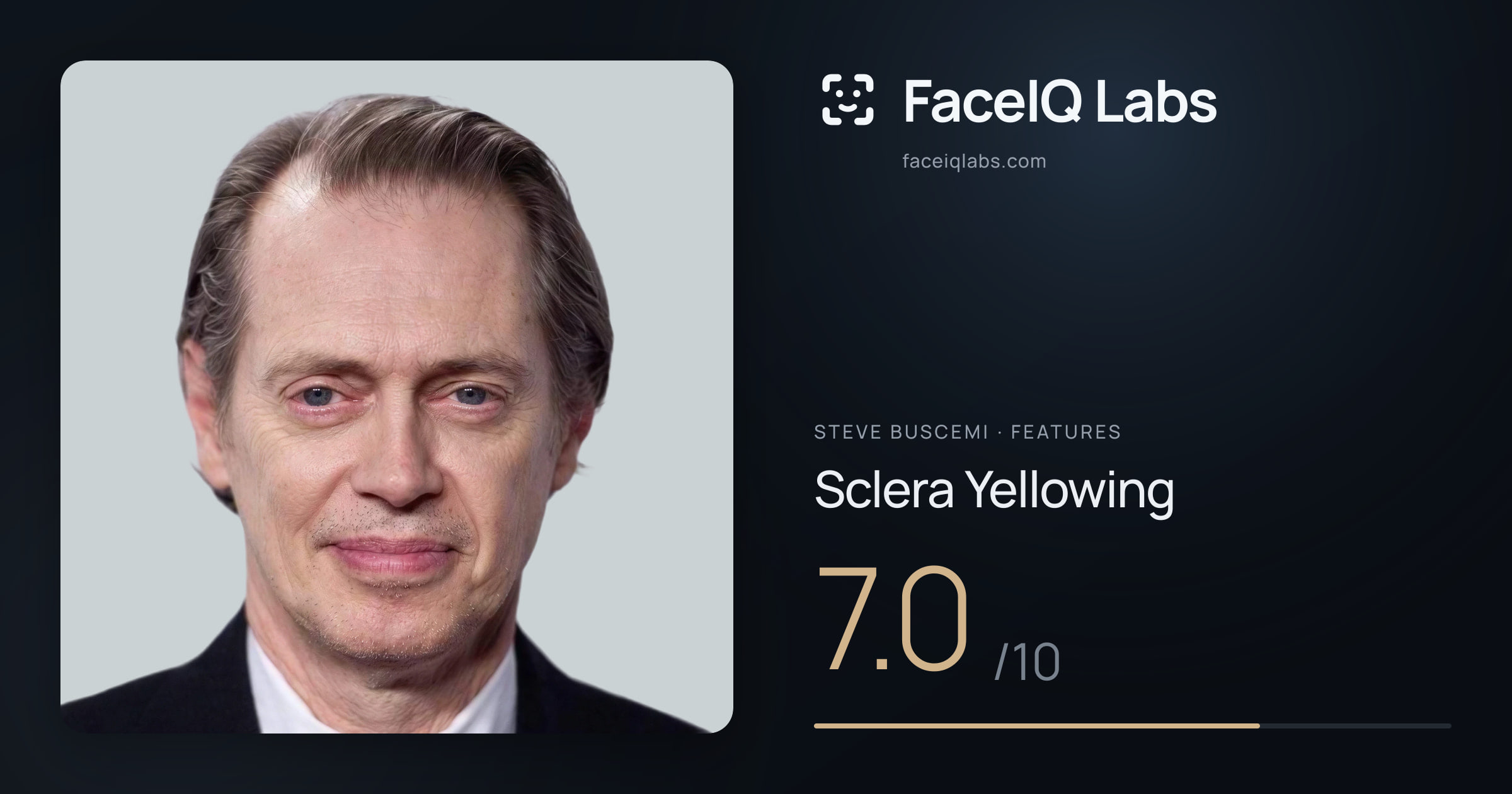 Steve Buscemi Sclera Yellowing: 7.0/10, drawn on the photo