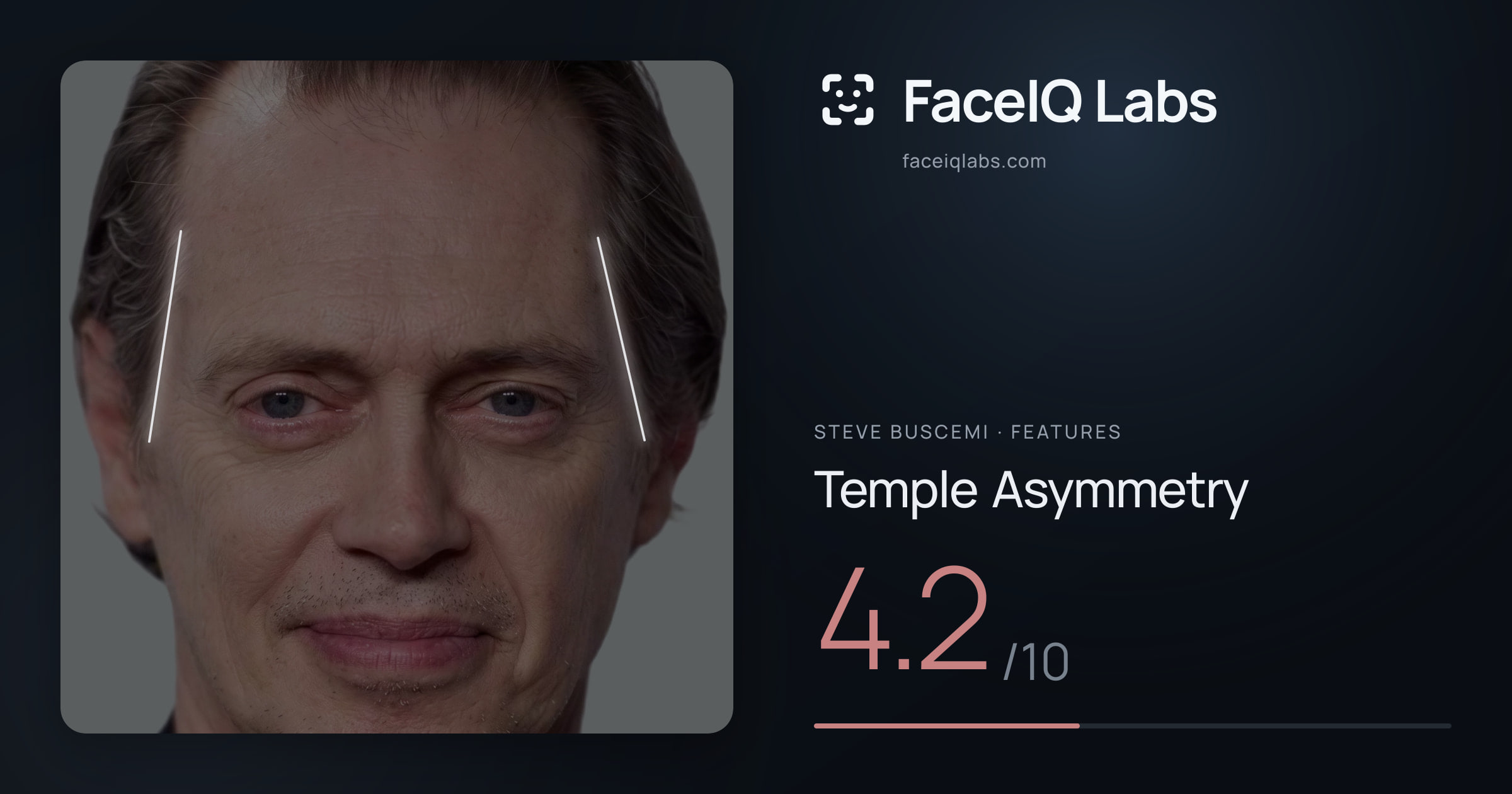 Steve Buscemi Temple Asymmetry: 4.2/10, drawn on the photo