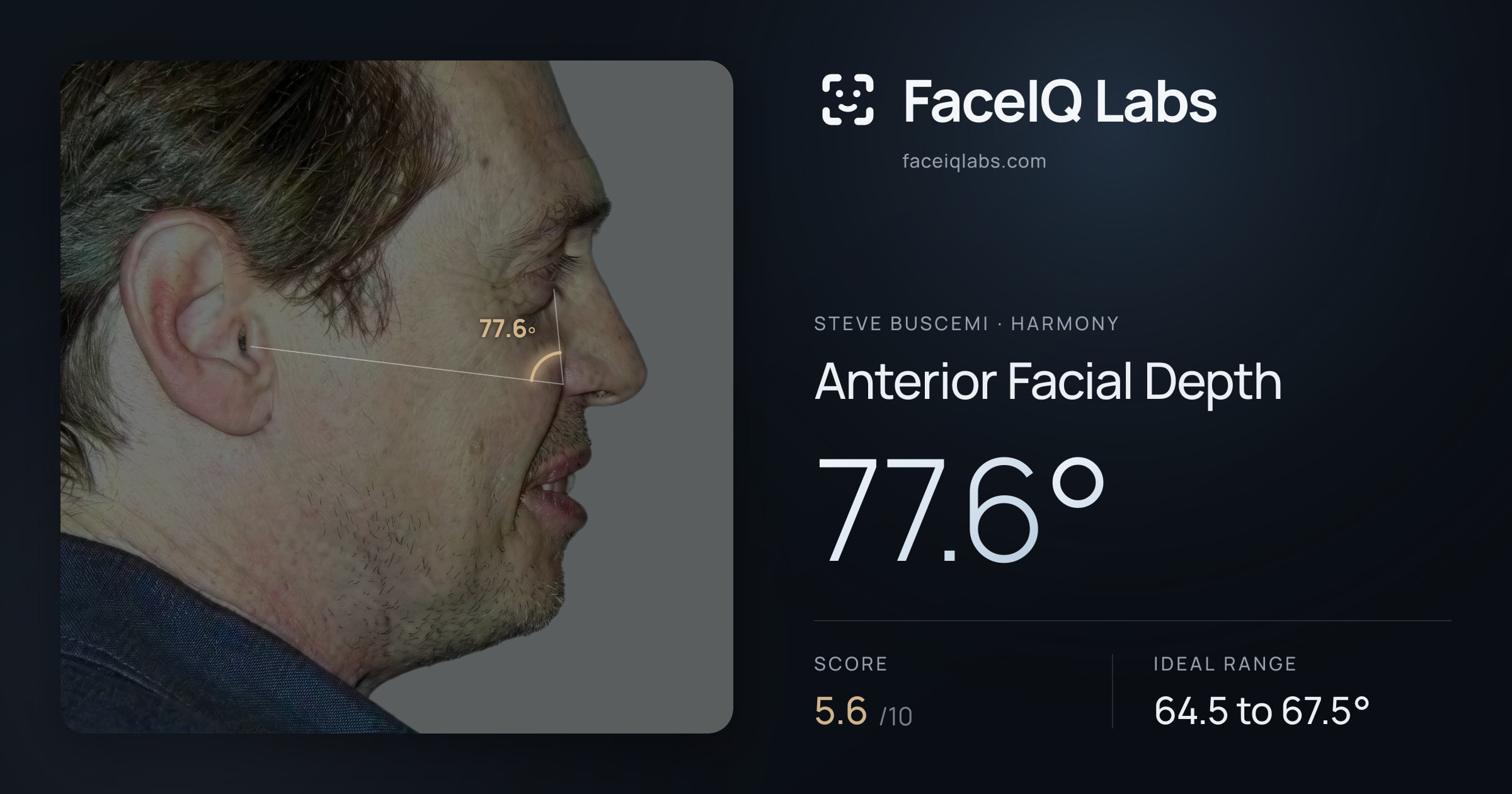 Steve Buscemi Anterior Facial Depth: 77.6°, drawn on the photo