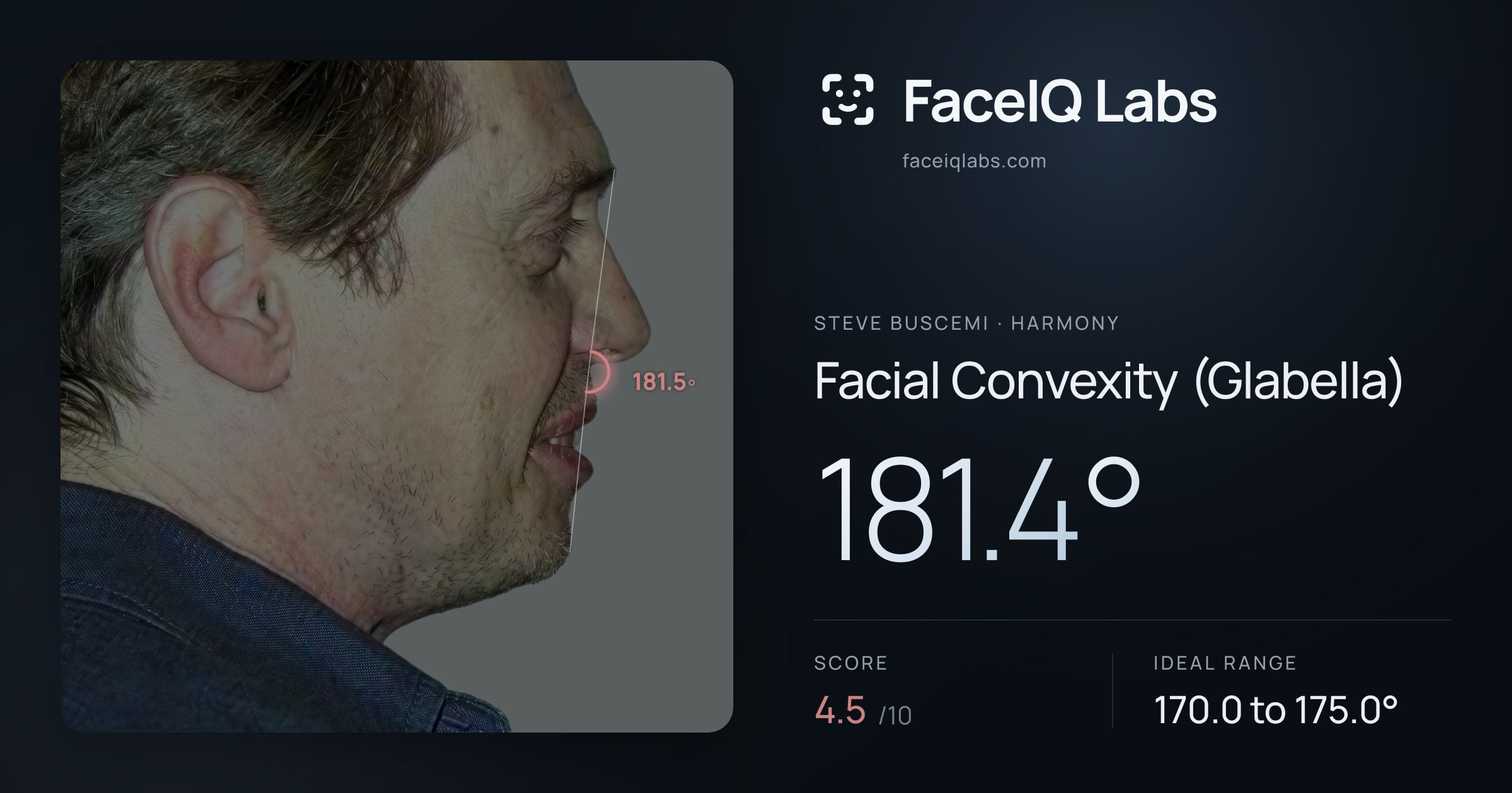 Steve Buscemi Facial Convexity (Glabella): 181.4°, drawn on the photo