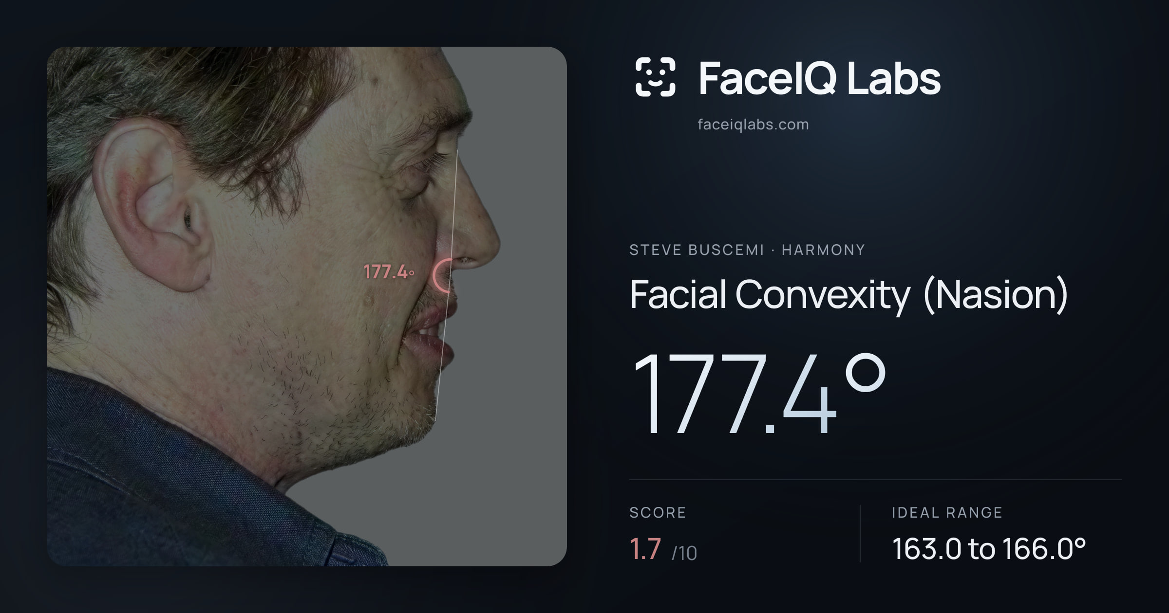 Steve Buscemi Facial Convexity (Nasion): 177.4°, drawn on the photo