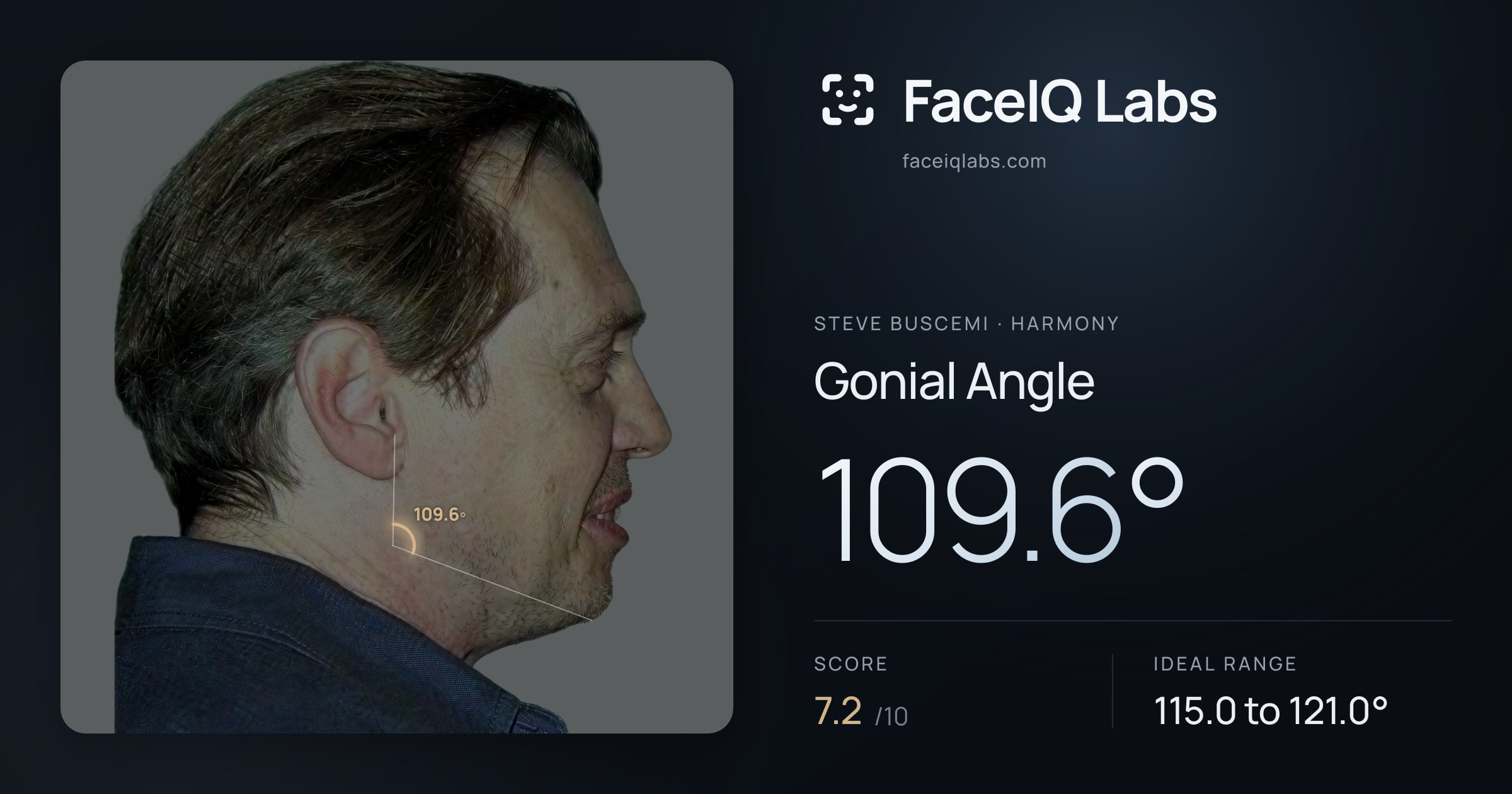 Steve Buscemi Gonial Angle: 109.6°, drawn on the photo