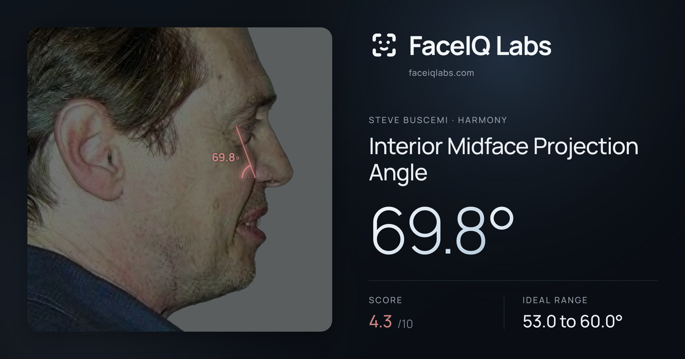 Steve Buscemi Interior Midface Projection Angle: 69.8°, drawn on the photo