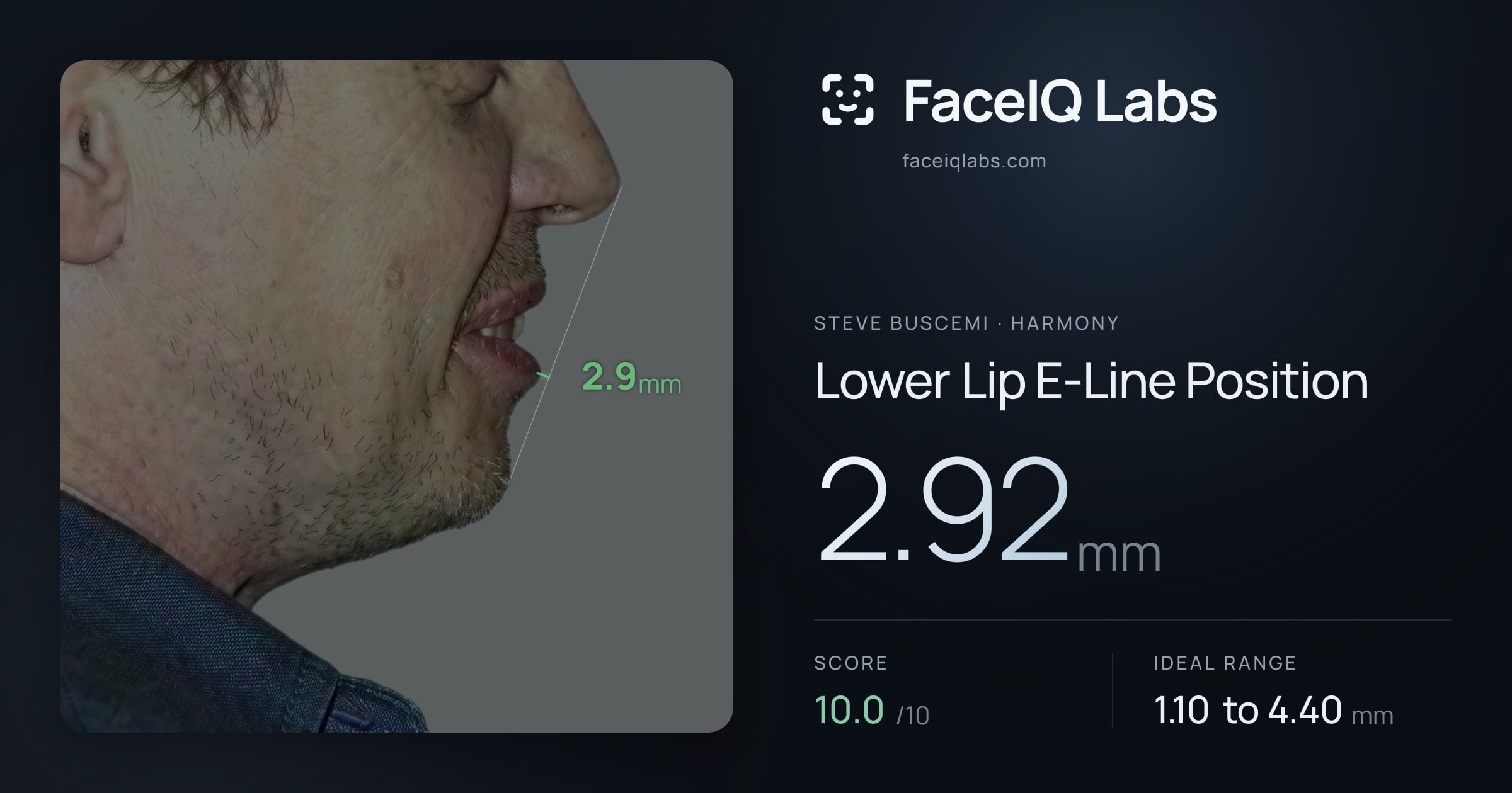 Steve Buscemi Lower Lip E-Line Position: 2.92mm, drawn on the photo